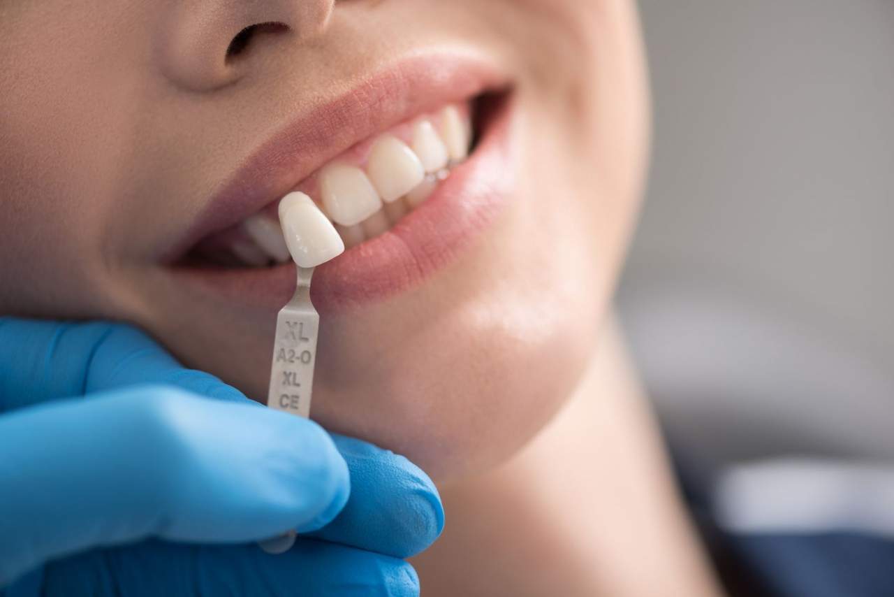 Clínica dental Helident en Sevilla: las búsquedas acerca de los implantes dentales en Sevilla