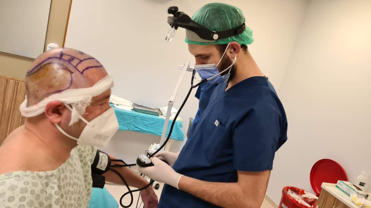 Fue Hair Transplant System: Turismo capilar en Turquía