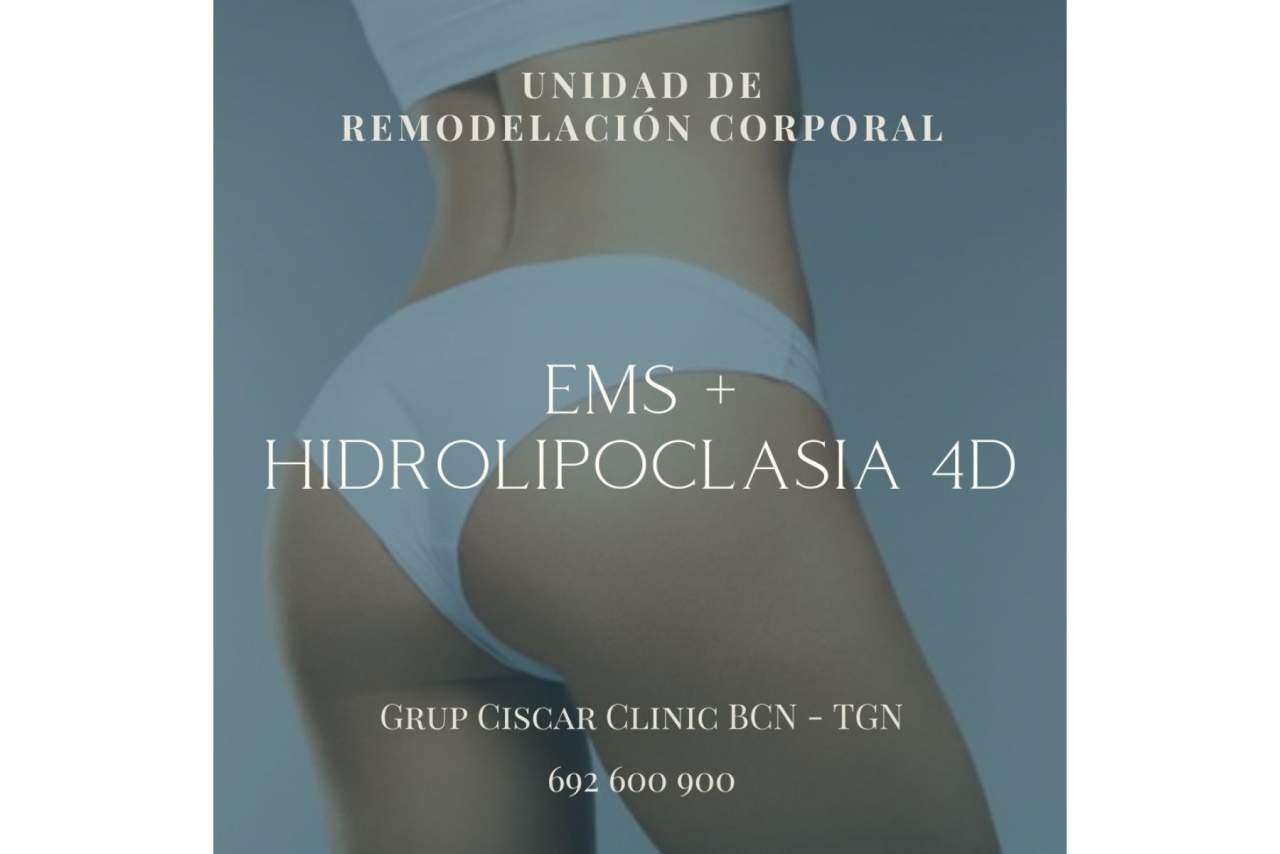Hidrolipoclasia 4D antes y después: Así es el tratamiento que permite eliminar grasa localizada en Barcelona por la Clínica Ciscar