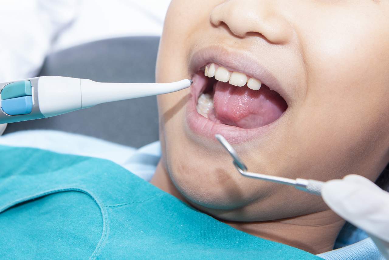 ¿Cuál es una de las mejores opciones para ir al dentista en el sur de Sevilla? Clínica Dental Helident