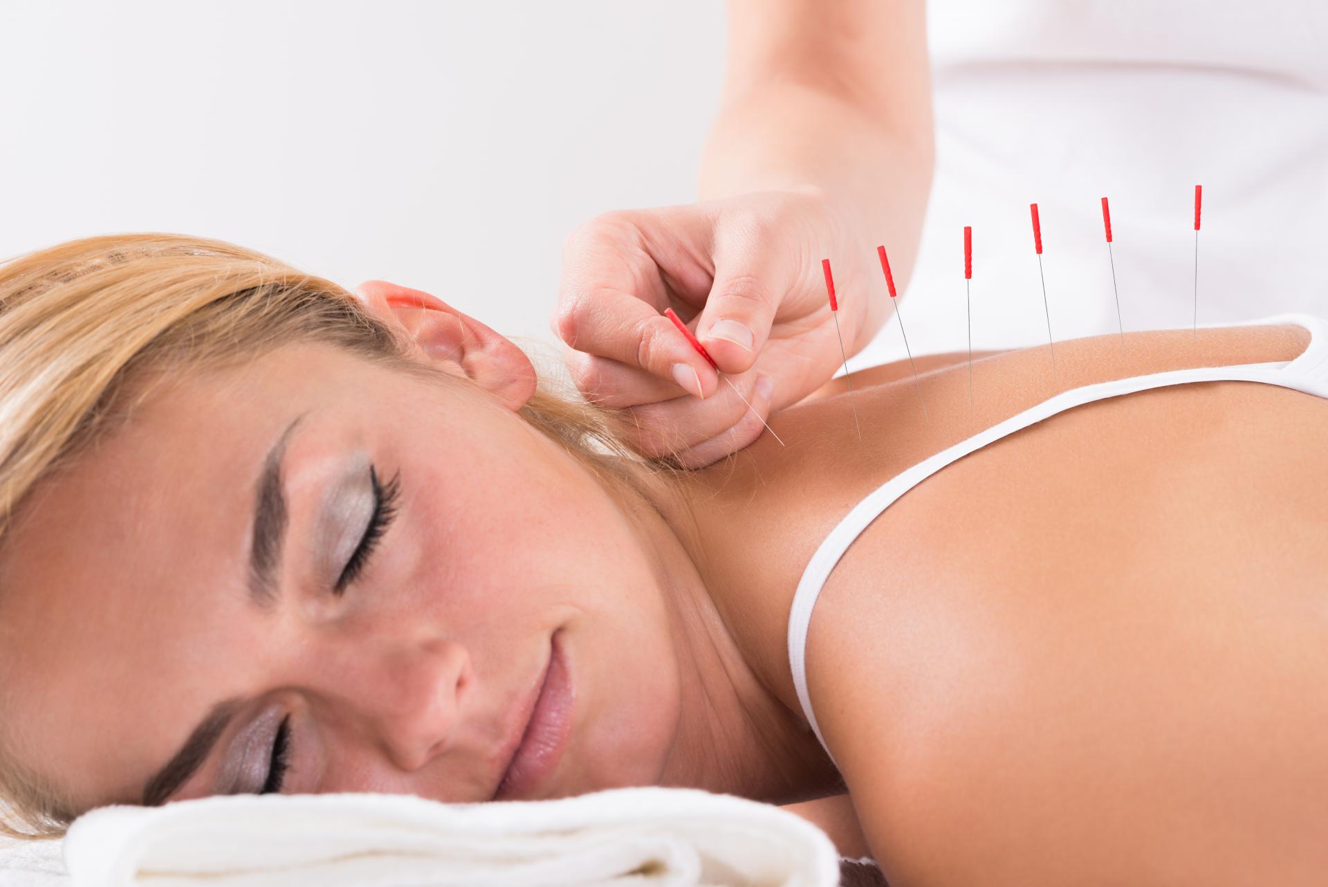 Las terapias alternativas en Mallorca ofrecidas por Kikai Acupuntura Mallorca
