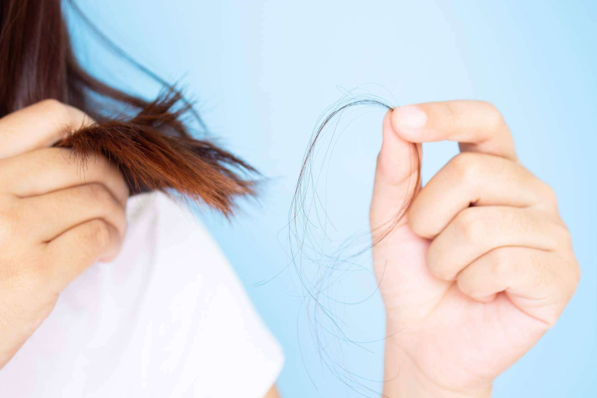 ¿Cómo remediar la caída de pelo hormonal o carencial con el tratamiento efectivo de Géomer?
