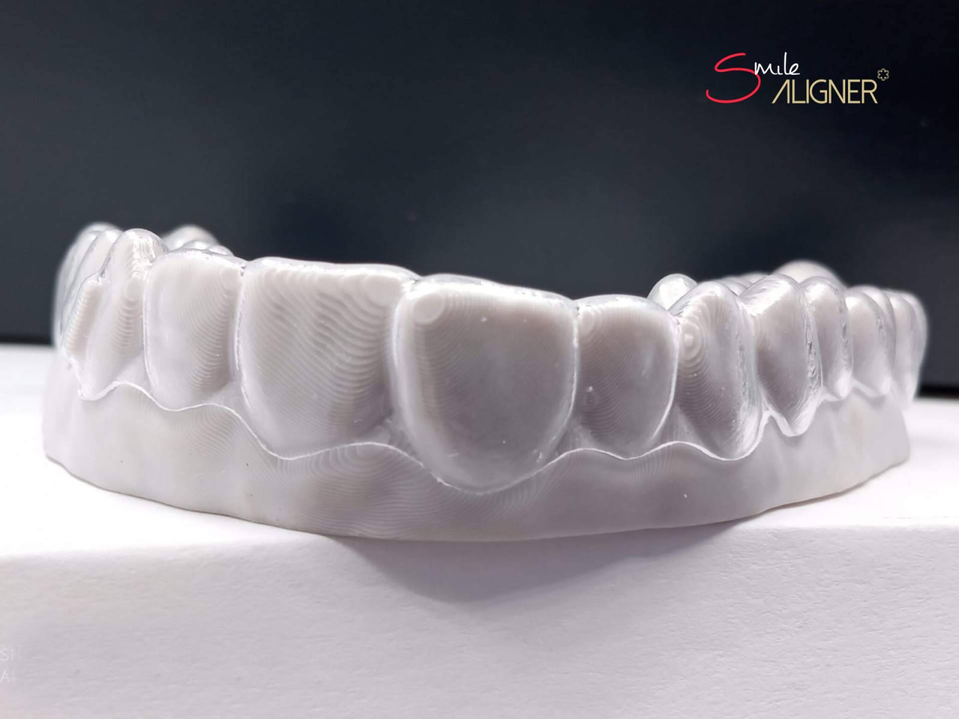Smile Aligner: la ortodoncia invisible en exclusiva de Clínicas Hernadent