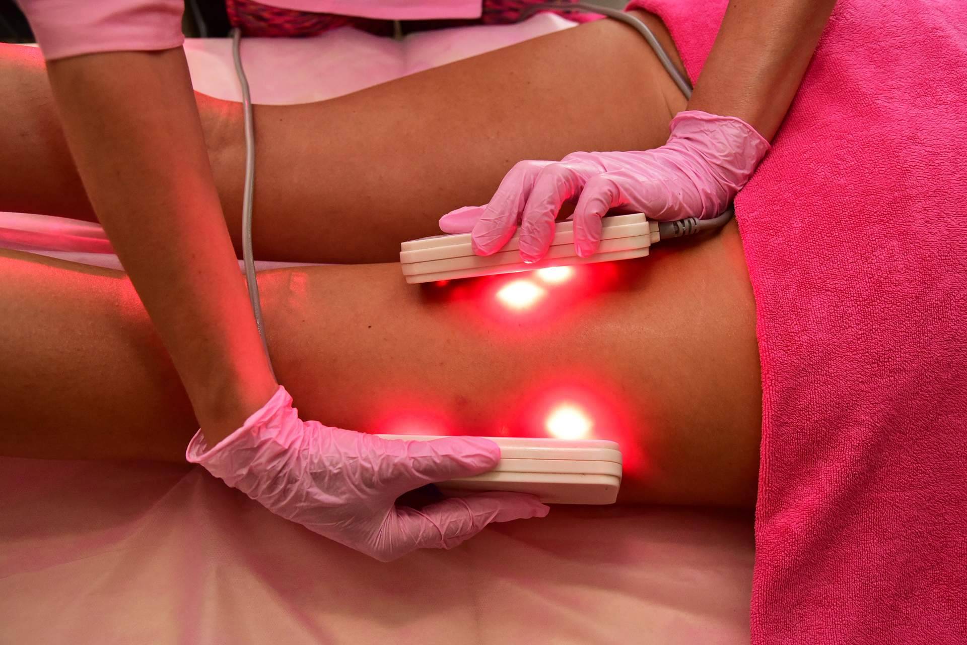¿Por qué el lipoláser es una de las técnicas más solicitadas en el centro de estética de Madrid Crina Rus Beauty Center?