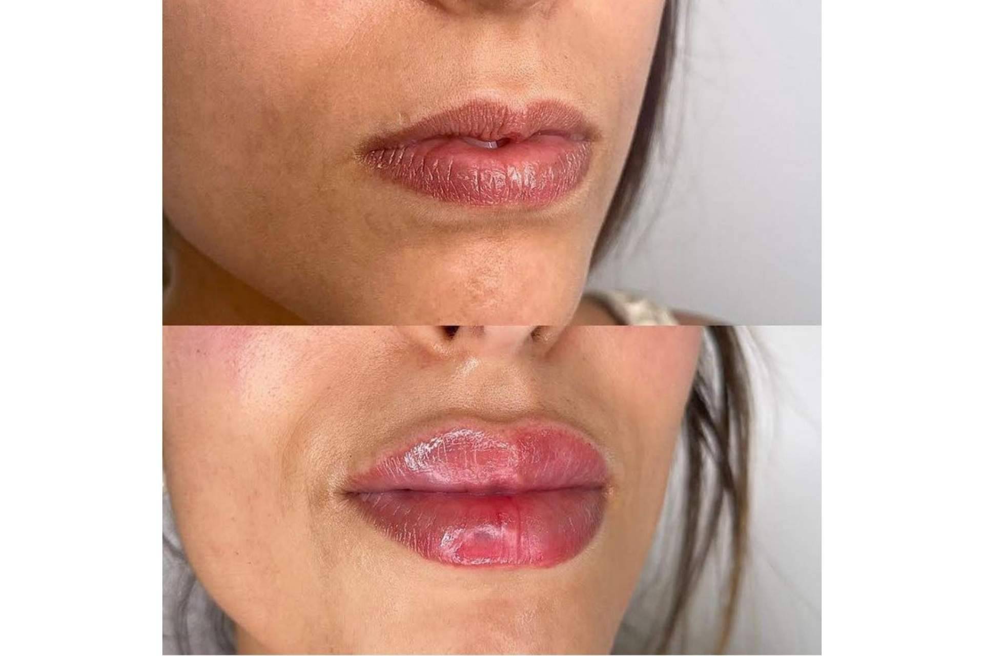 ¿Es posible revitalizar la expresión facial de mujeres y hombres mediante tratamientos estéticos?: Doctor Castellar