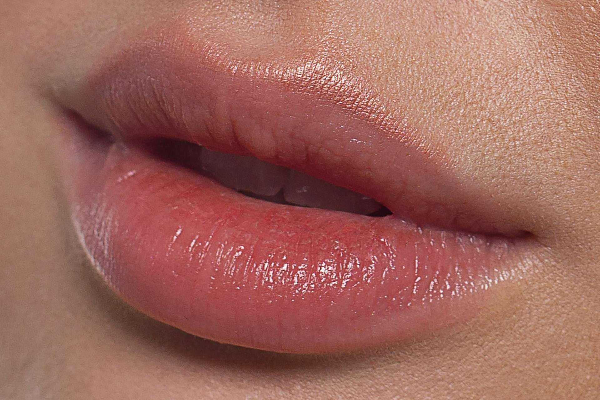 El tratamiento de aumento de labios realizado por ABB Medicina Estética