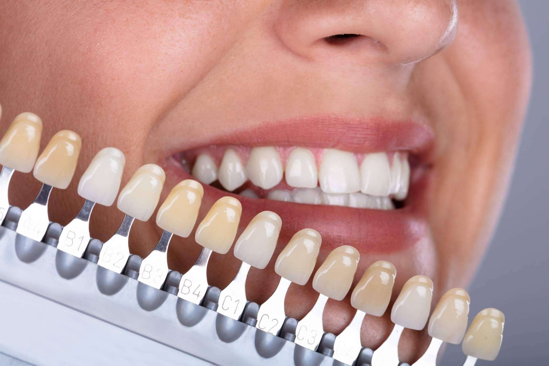 Clínica Viasalud: mejorar la sonrisa con tratamientos de ortodoncia