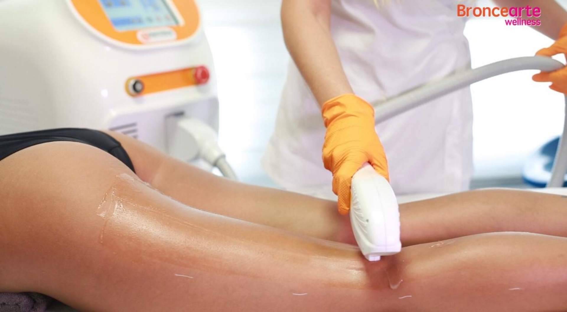 Se estima que las personas se depilan más de 7000 veces a lo largo de la vida. La depilación láser de Broncearte Wellness le pone fin
