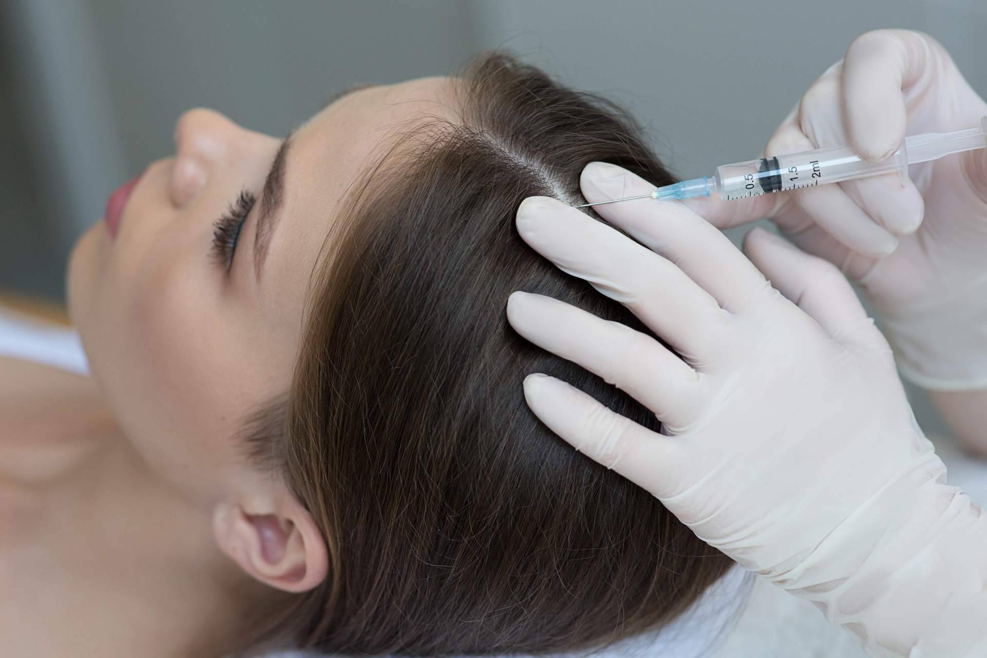 ¿Mesoterapia capilar o láser capilar? Tratamientos de Élite Capilar