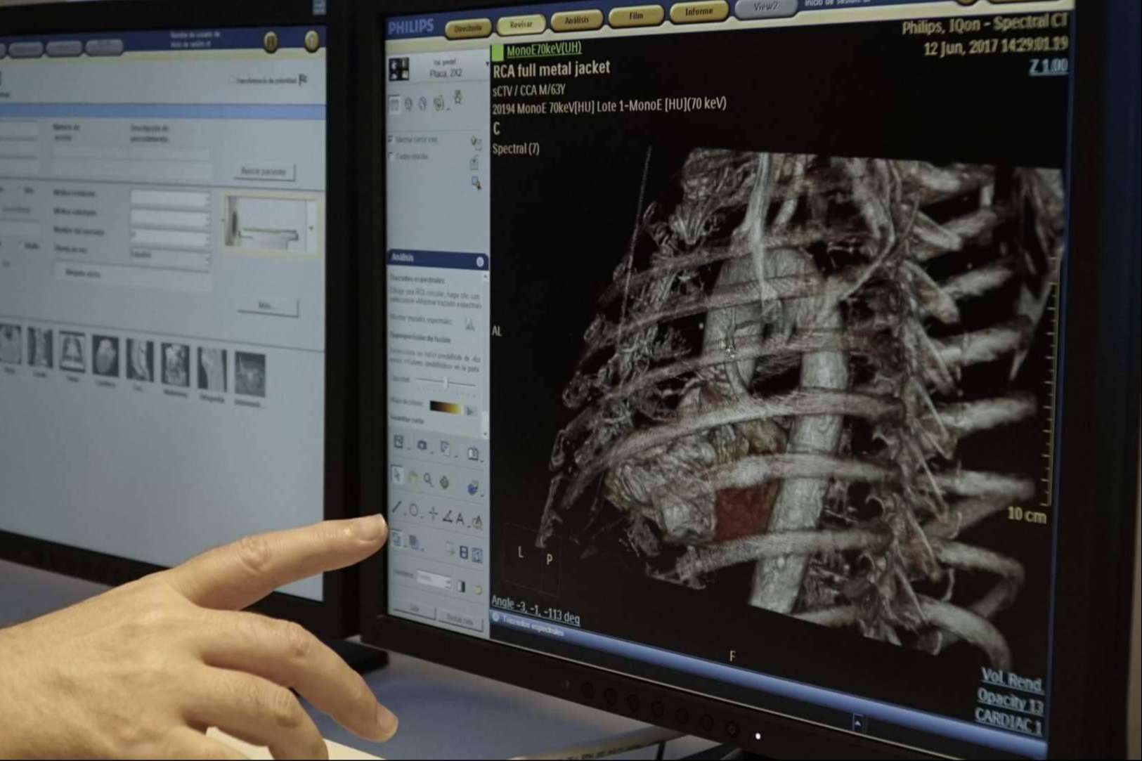 El escáner de imagen espectral de Bach Care permite la prevención y detección de patologías o anomalías cardiovasculares