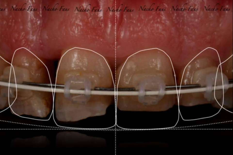 Las técnicas avanzadas en implantología: odontología digital de la mano de Clínica Blay Monzó