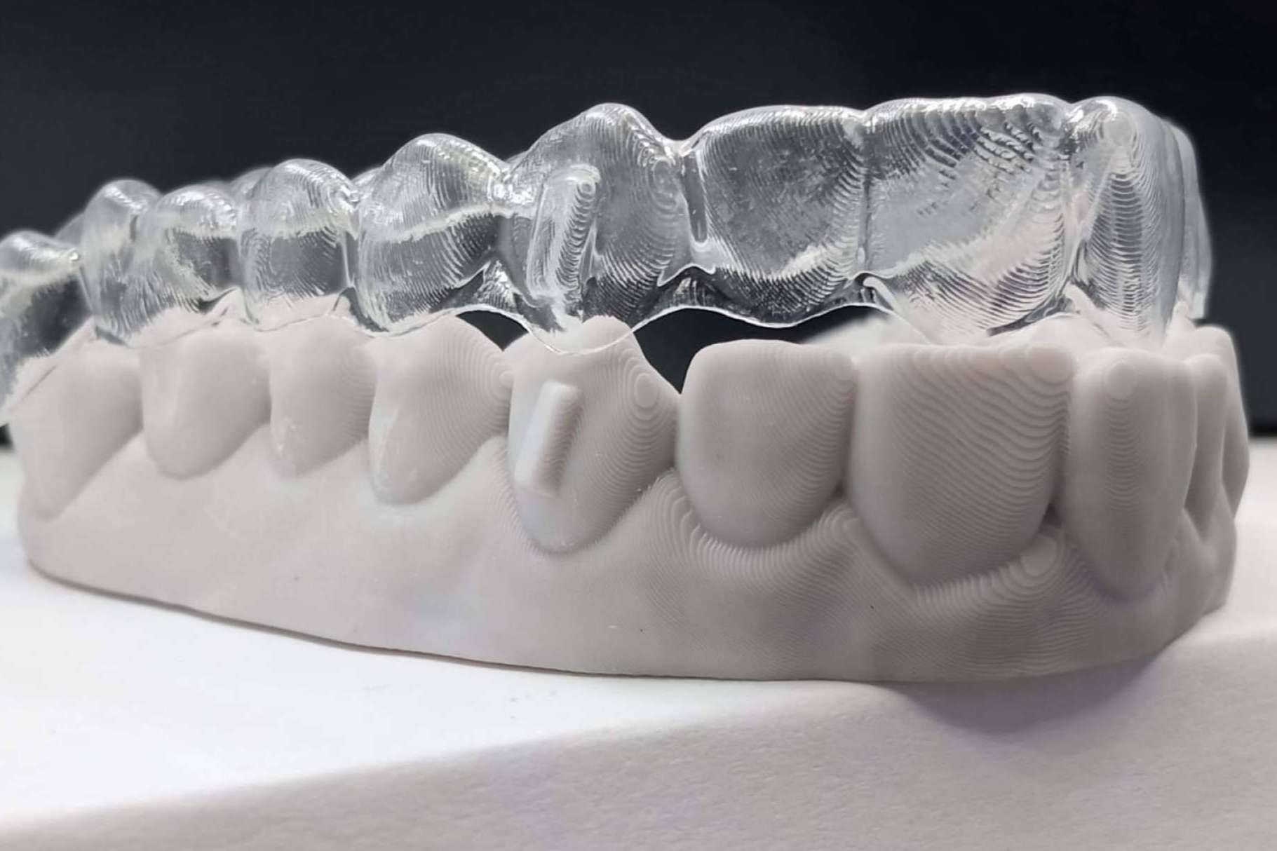 Los beneficios de elegir Smile Aligner como ortodoncia invisible