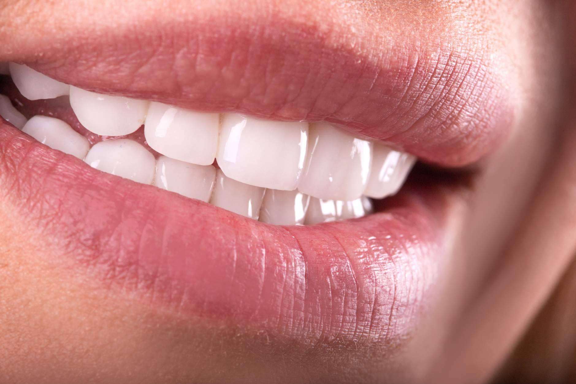 Implantes dentales de calidad y profesionalidad durante el tratamiento con Clínica Sonrisas de Corrales Dental
