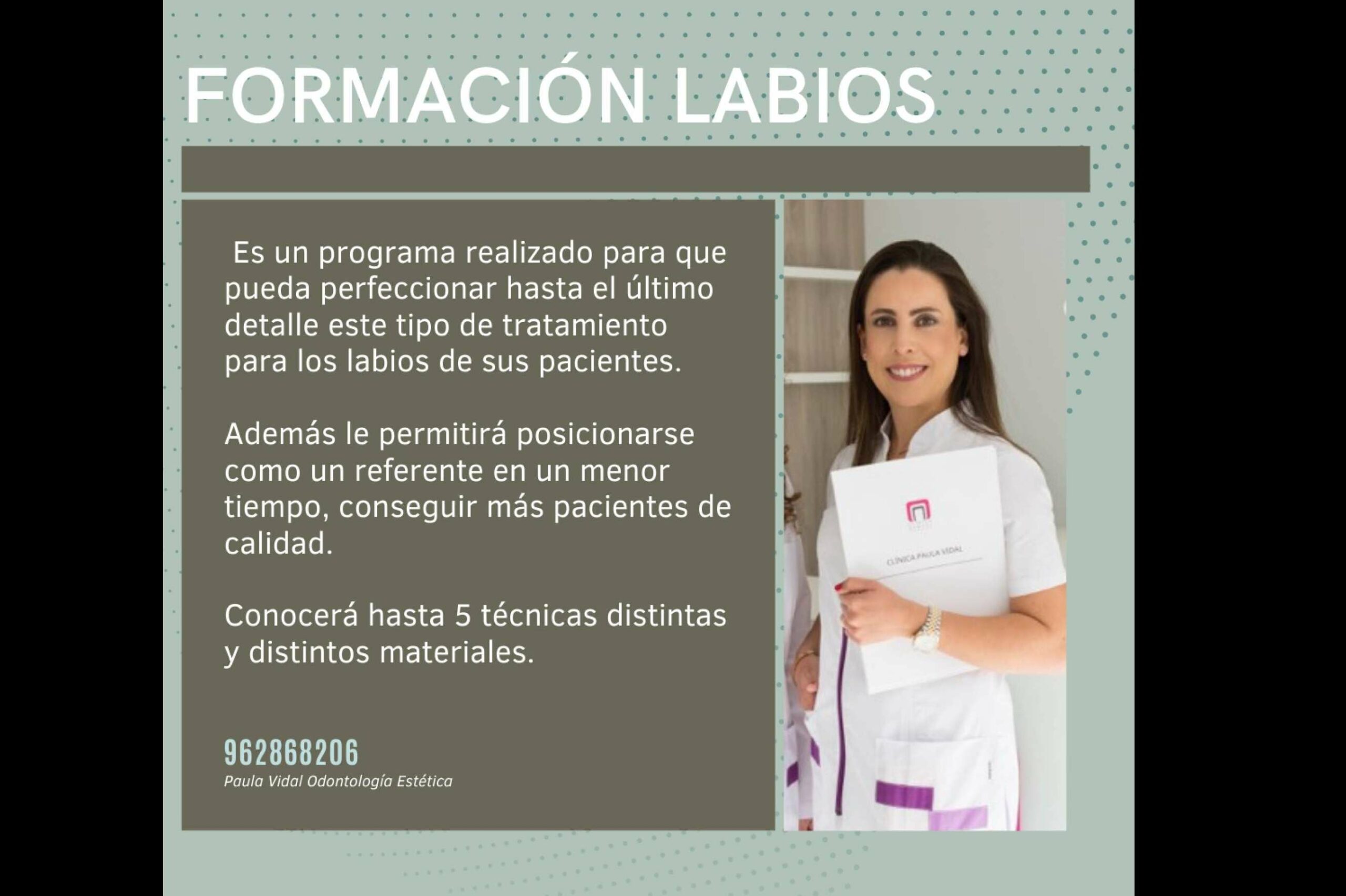 Clínica Paula Vidal, curso para odontólogos de relleno de ácido hialurónico