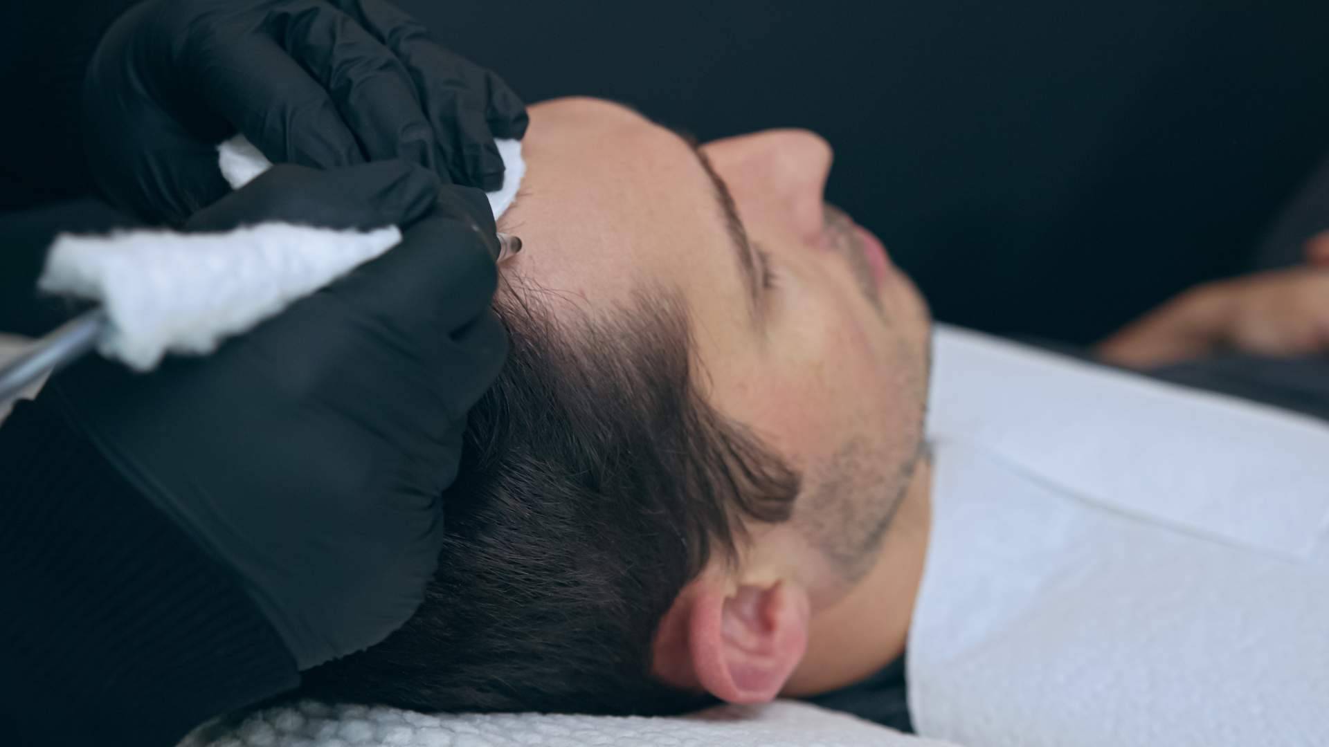 Los tratamientos de micropigmentación con efecto de redensificación que realizan las Clínicas Dr. Pelo