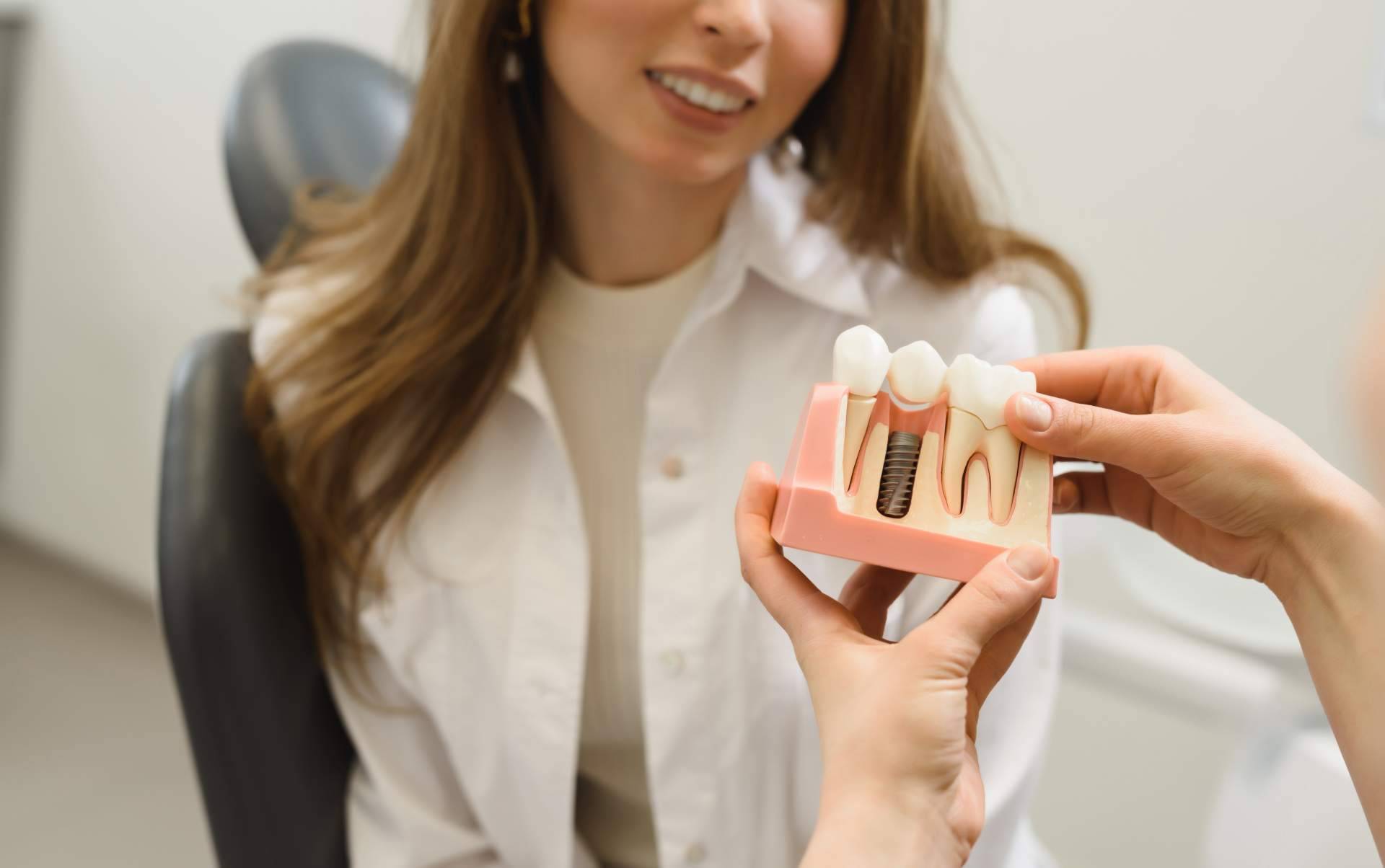 Uno de los mejores servicios de implantes dentales de Madrid