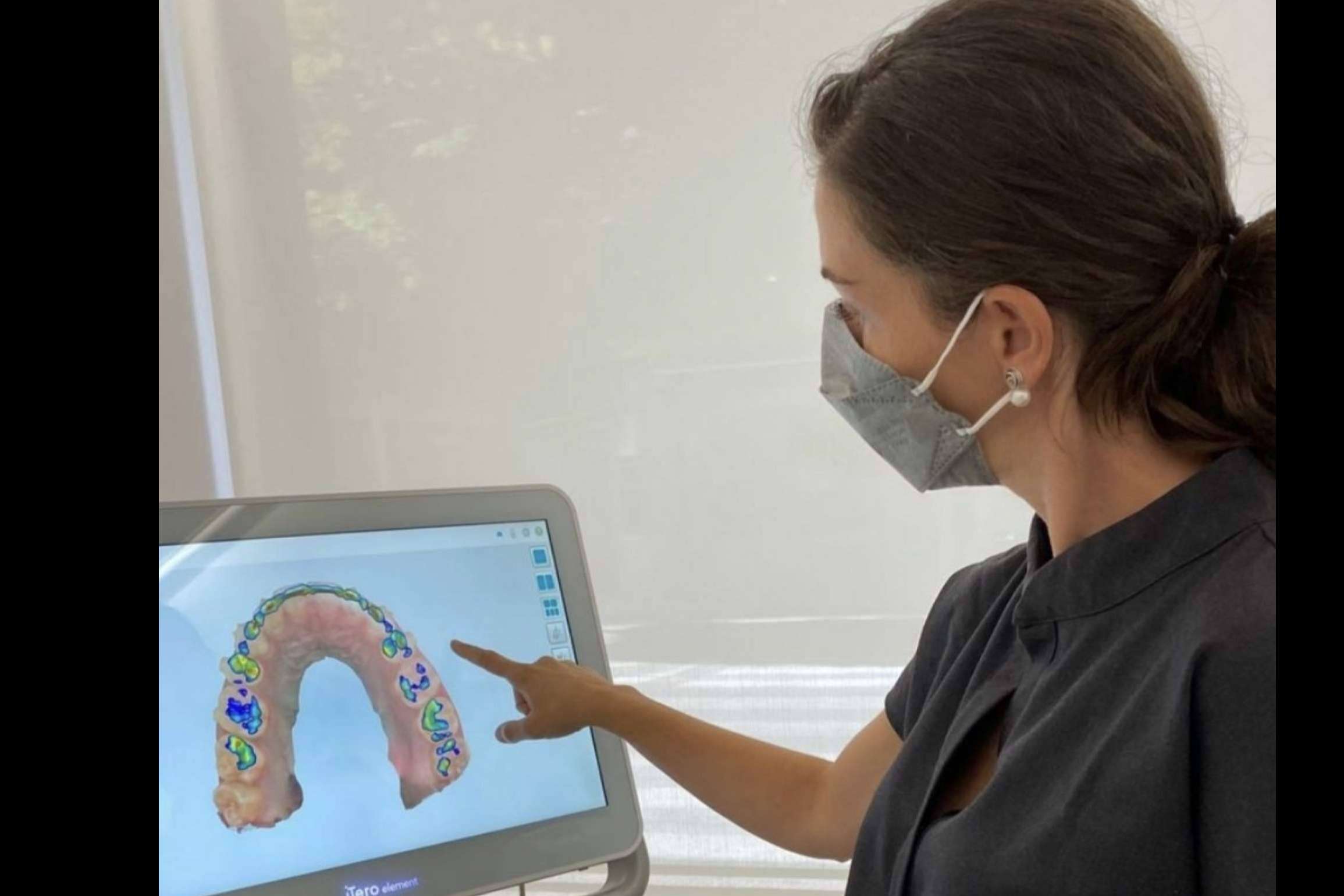 ¿Qué ventajas ofrece el tratamiento Invisalign? por Clínica dental Carmen Díaz