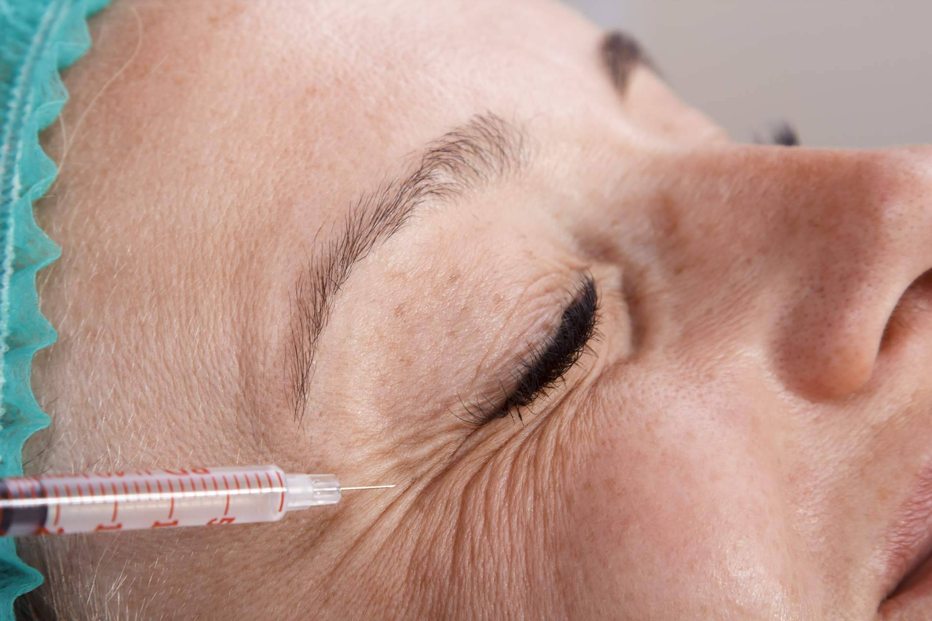 Lifting facial sin cirugía y otros tratamientos en Policlínica ICD