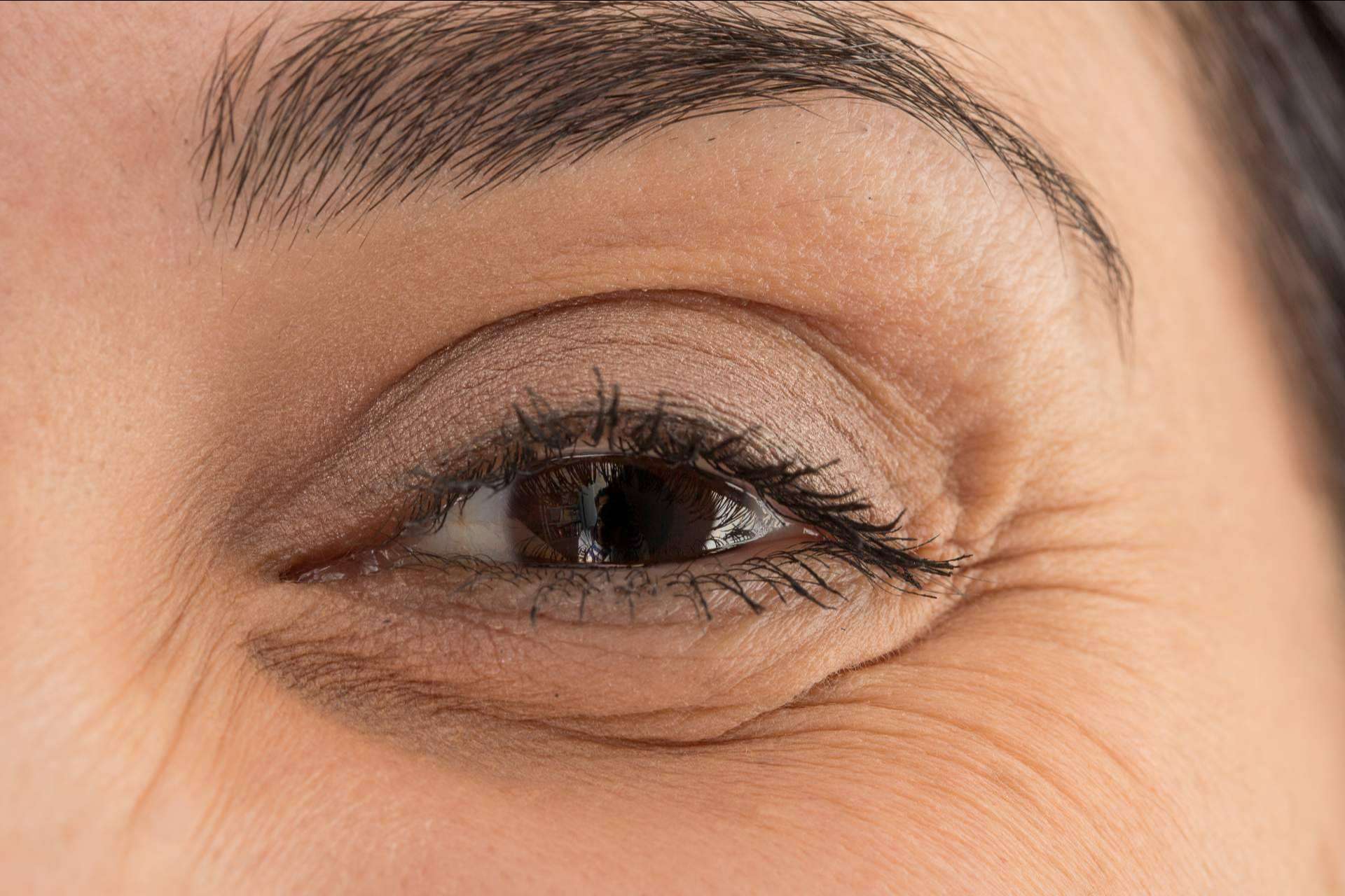 Dr. Carlos Zito, profesional en medicina estética de tratamientos de ojeras