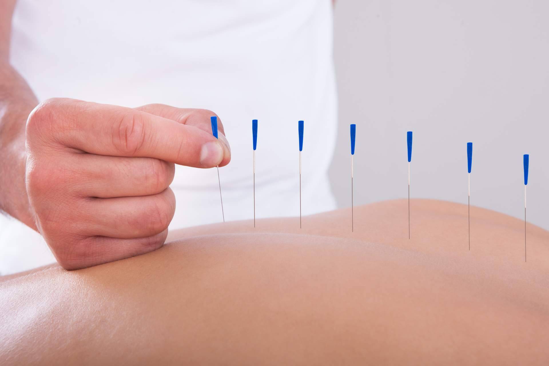 Trabajar de osteópata y acupuntor con formación internacional profesional