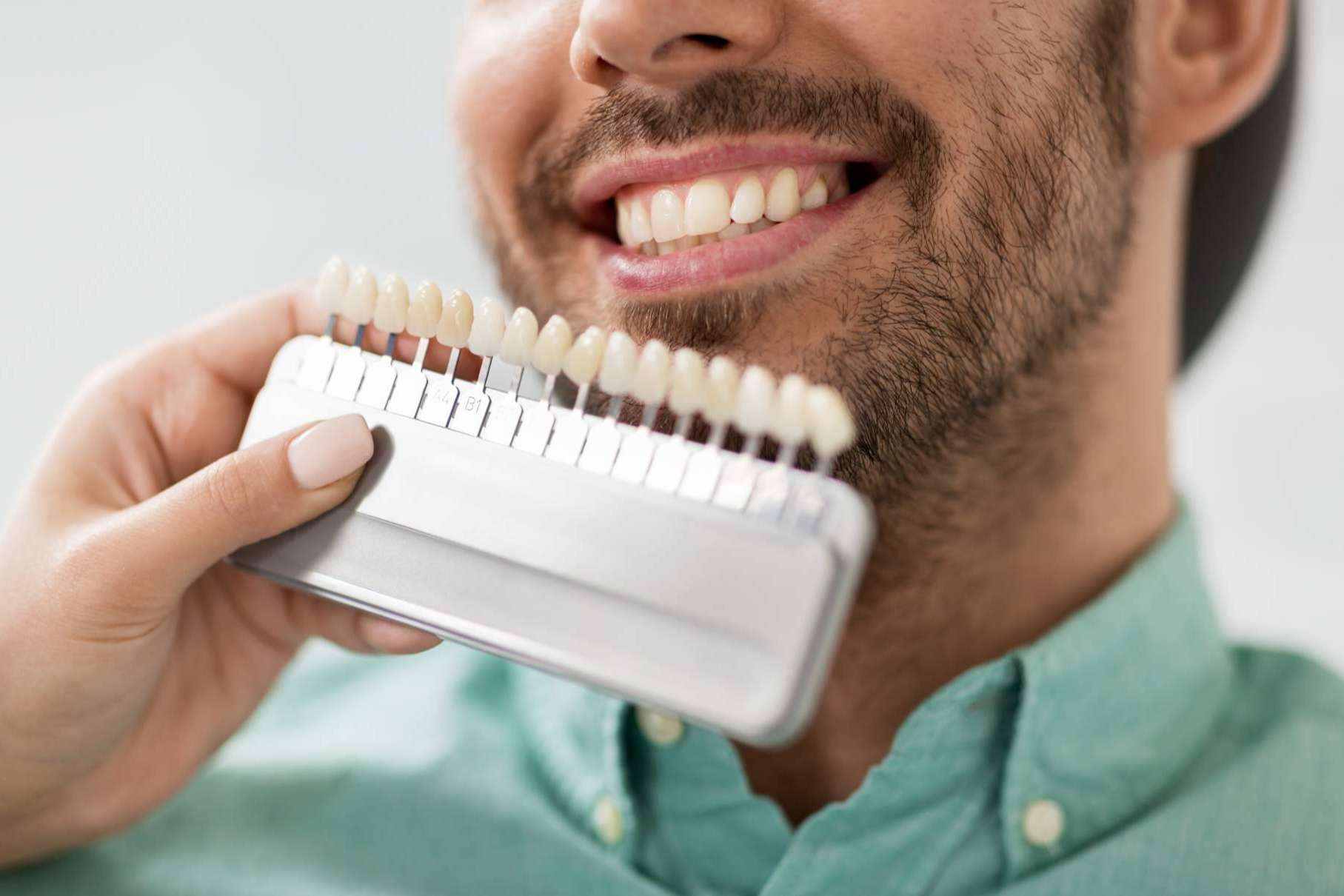El blanqueamiento dental en casa refuerza y mantiene los resultados del procedimiento clínico