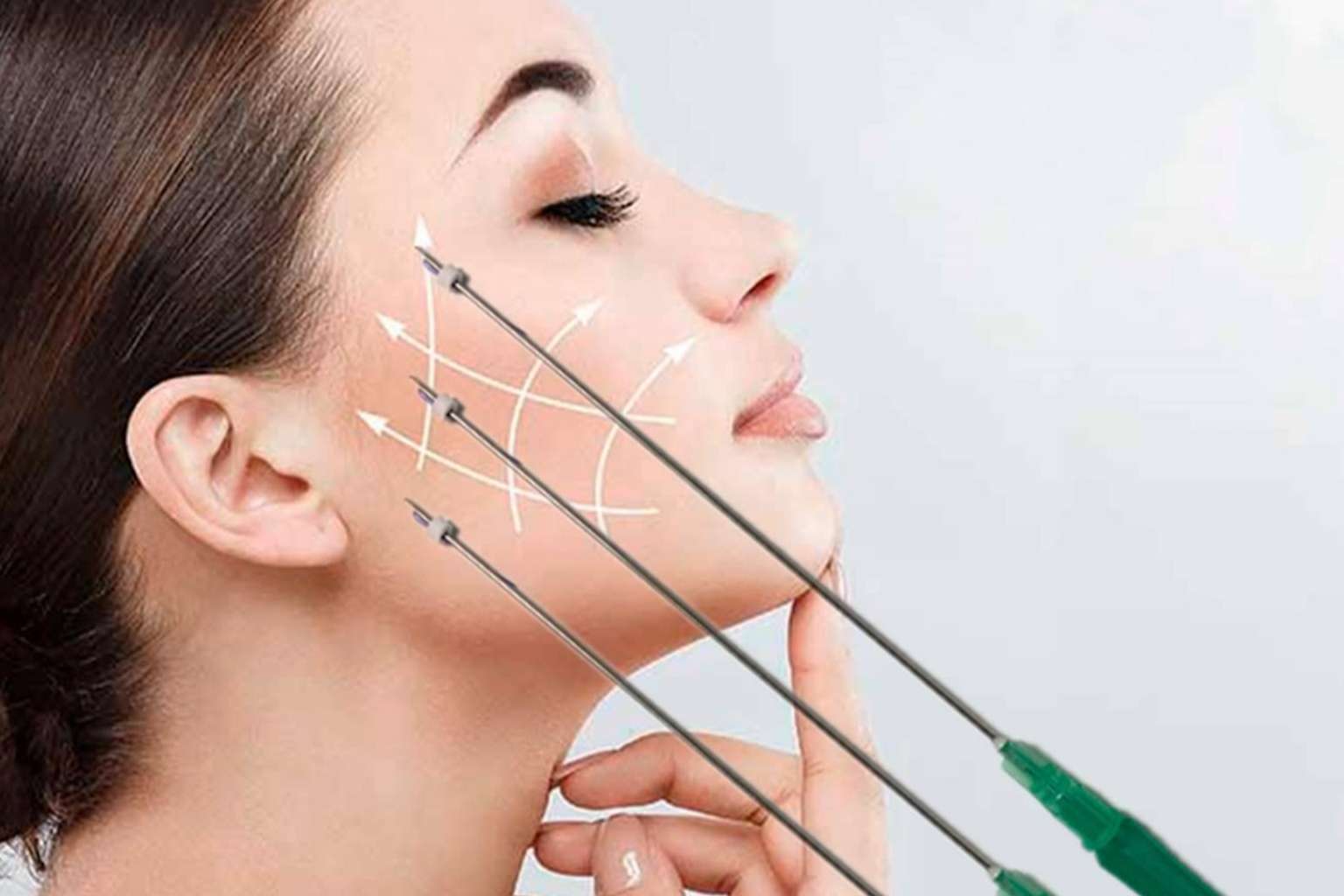 Combatir la flacidez con los hilos tensores, por Clínica Zero
