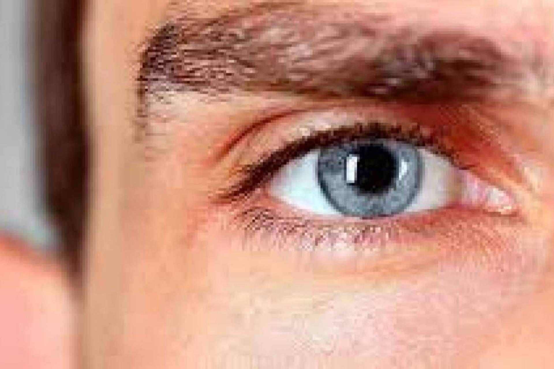 La segunda causa de ceguera en Occidente, el glaucoma