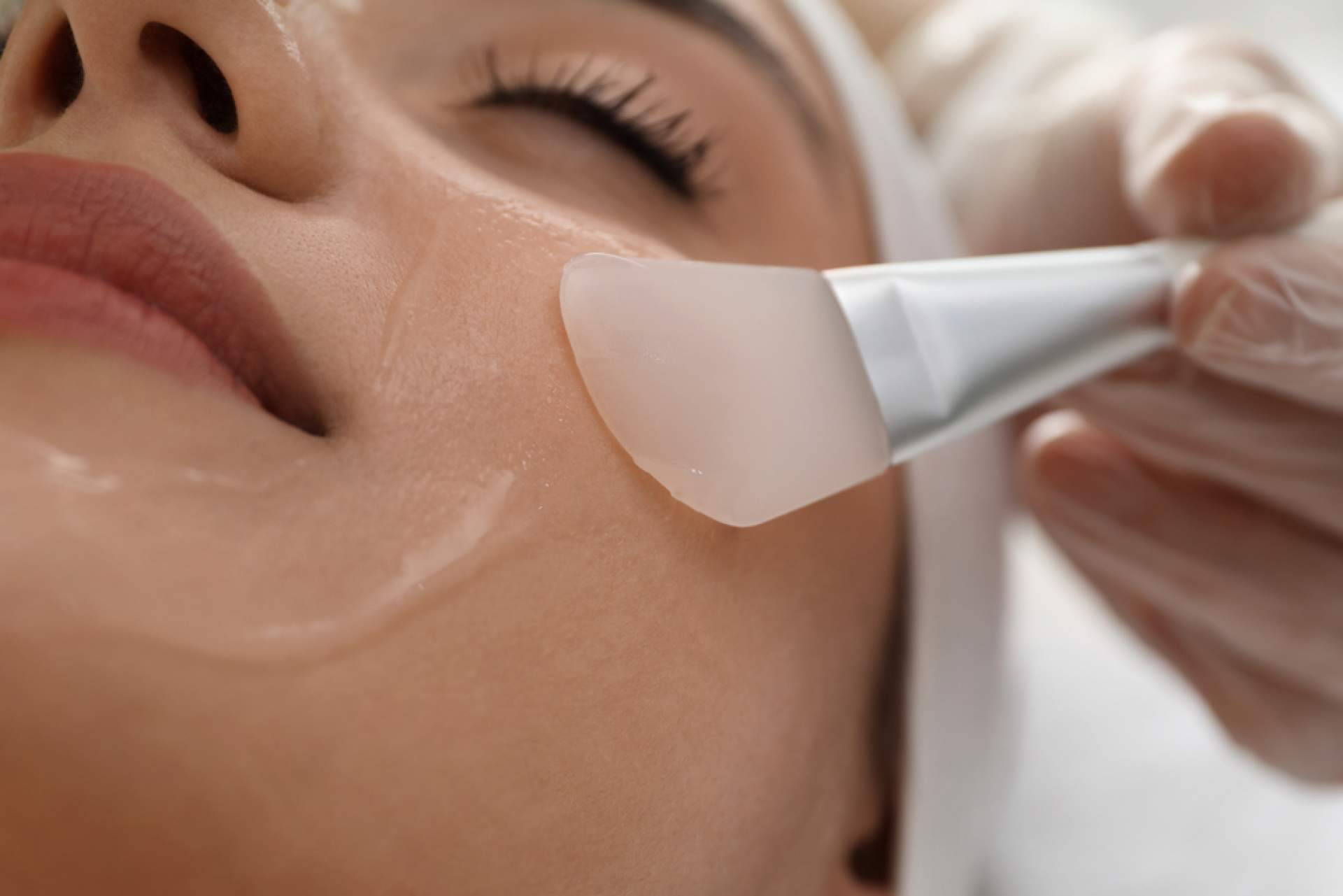 Peeling químico en diferentes partes del cuerpo, con Crina Rus Beauty Center