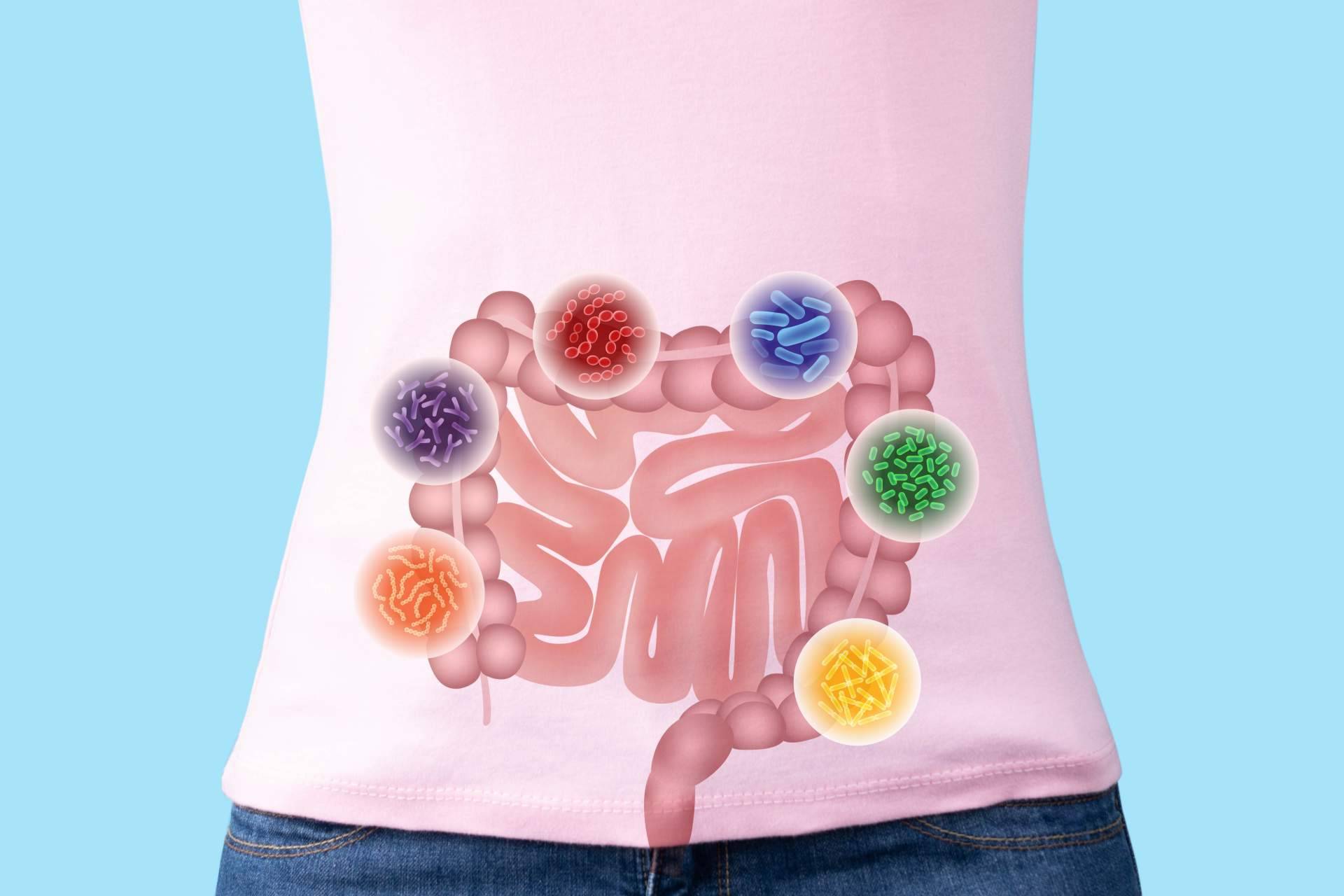 El tratamiento preferido de los jeques árabes, tratamiento de disbiosis modulación terapéutica y rehabilitación intestinal, por el Dr. Fernando Ruger Viarengo
