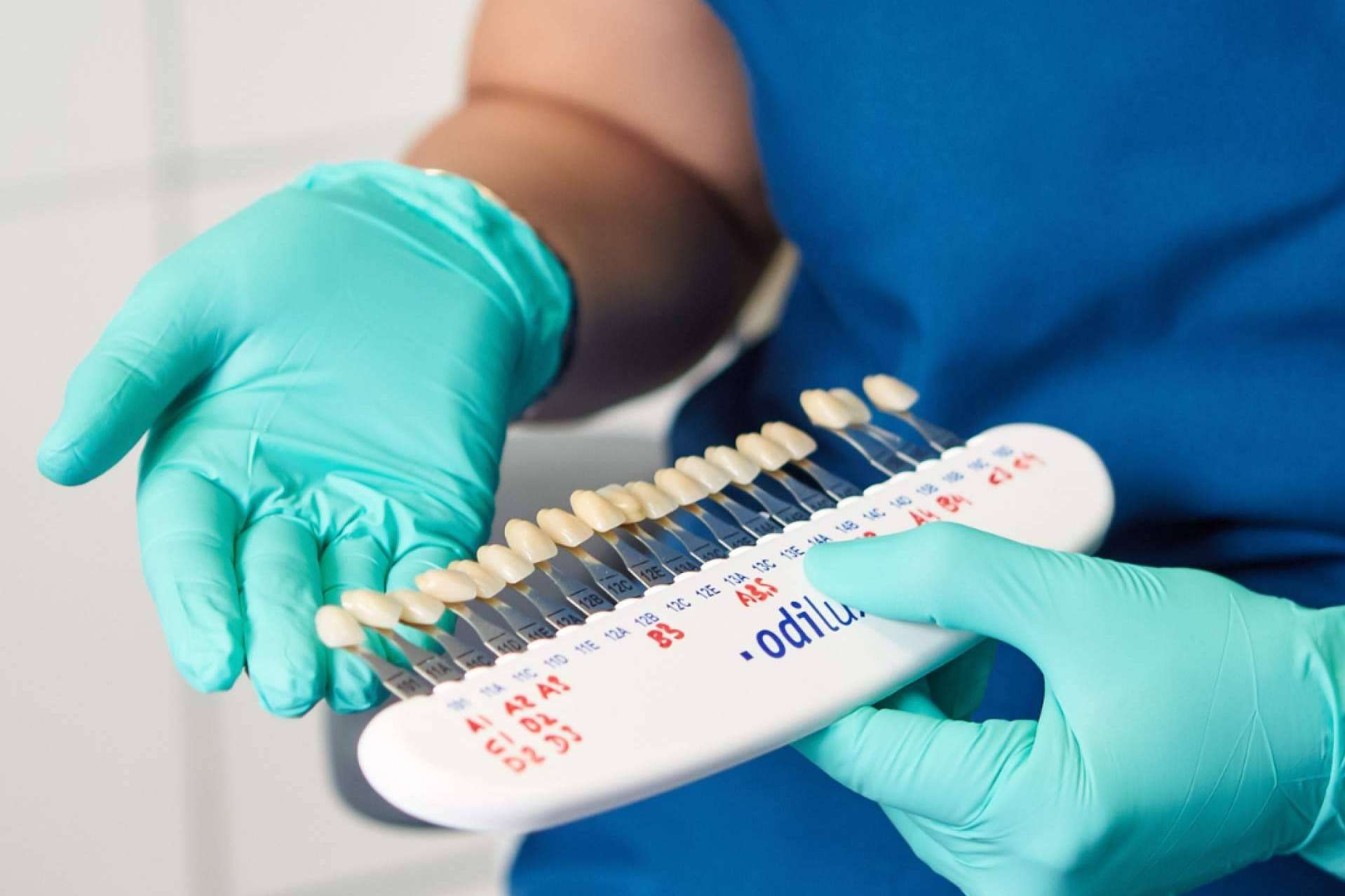 El tratamiento estético dental por excelencia, las carillas dentales