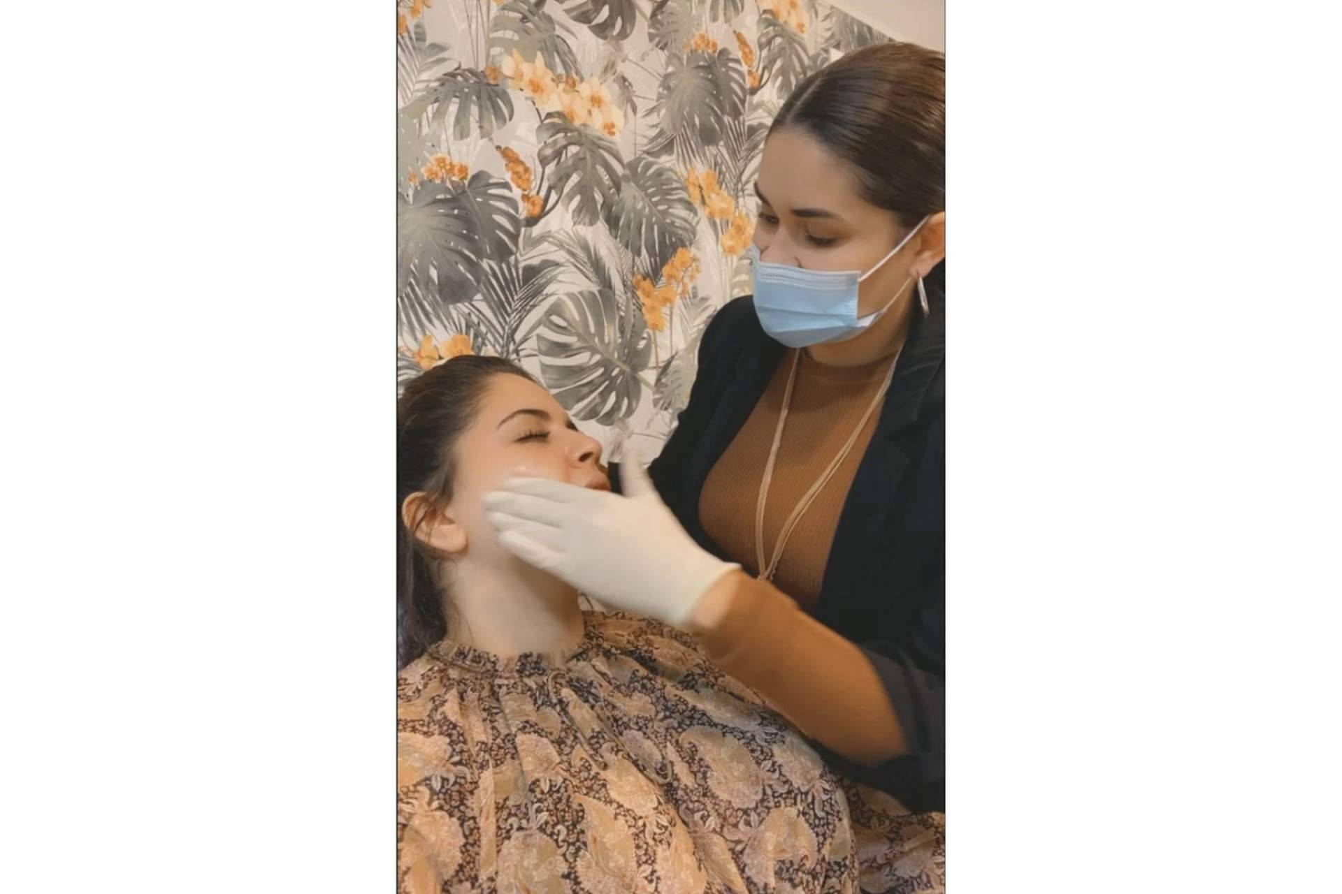 Peeling químico, qué es y qué beneficios tiene para la piel, con Cecilia Arthur