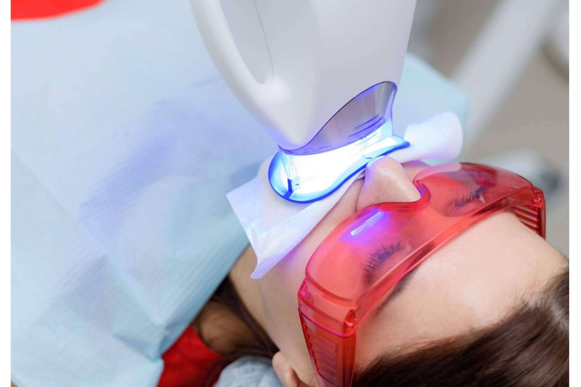 ¿Cómo se realiza un blanqueamiento dental? de la mano de Clínica Dental Delgado