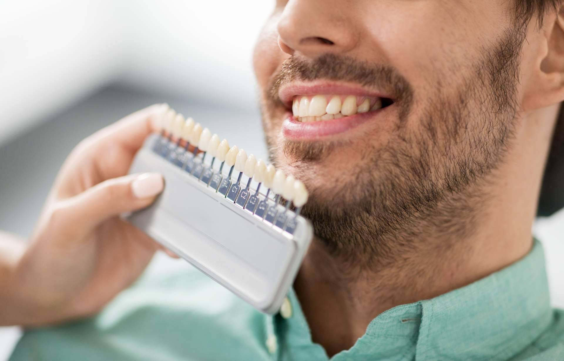 Clínica Dental Delgado mejora la sonrisa de sus pacientes con carillas dentales