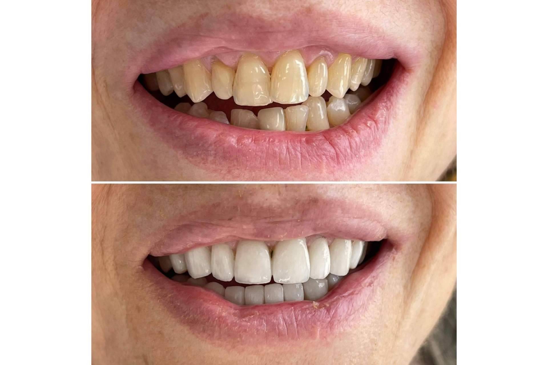 Especialistas en estética dental, con Clínica MG Dental