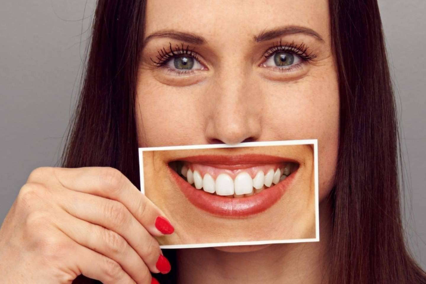 Tratamiento para la sonrisa gingival en la Clínica Dental Ruiz de Gopegui