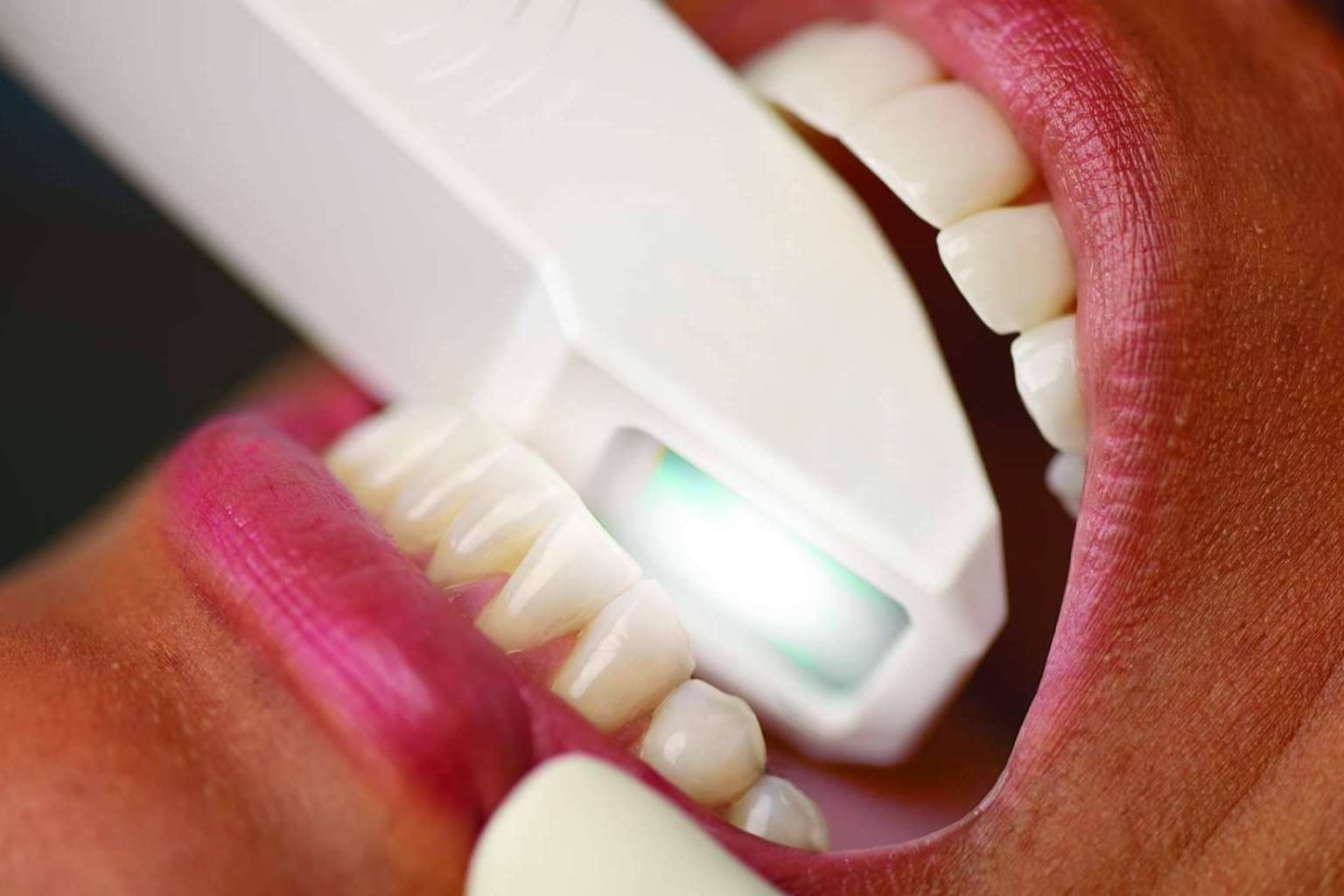 ¿Cuáles son las claves de la estética dental?, con el Instituto Odontológico Volpe