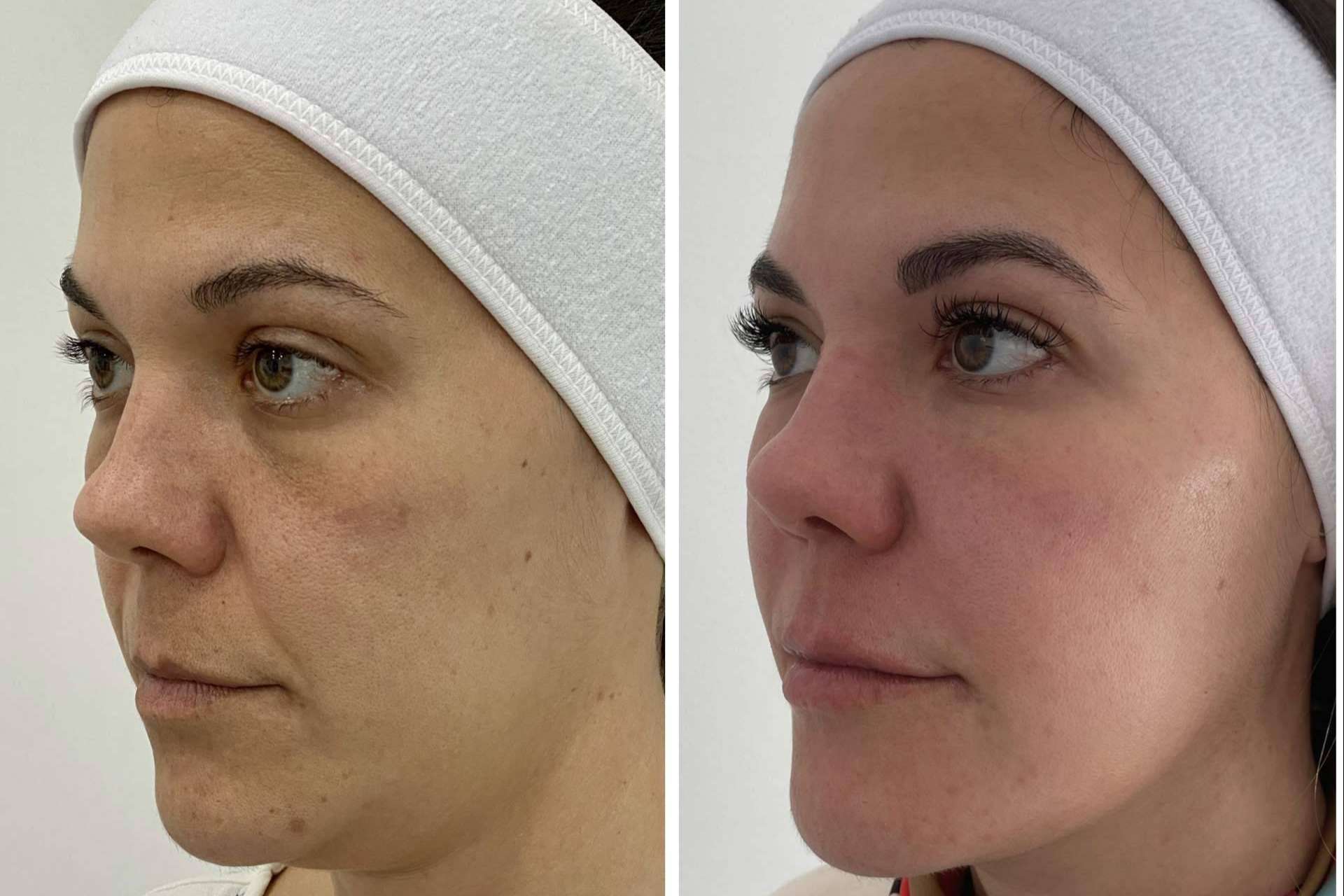 Los tratamientos faciales de Clínica VISO permiten a las personas mejorar su apariencia