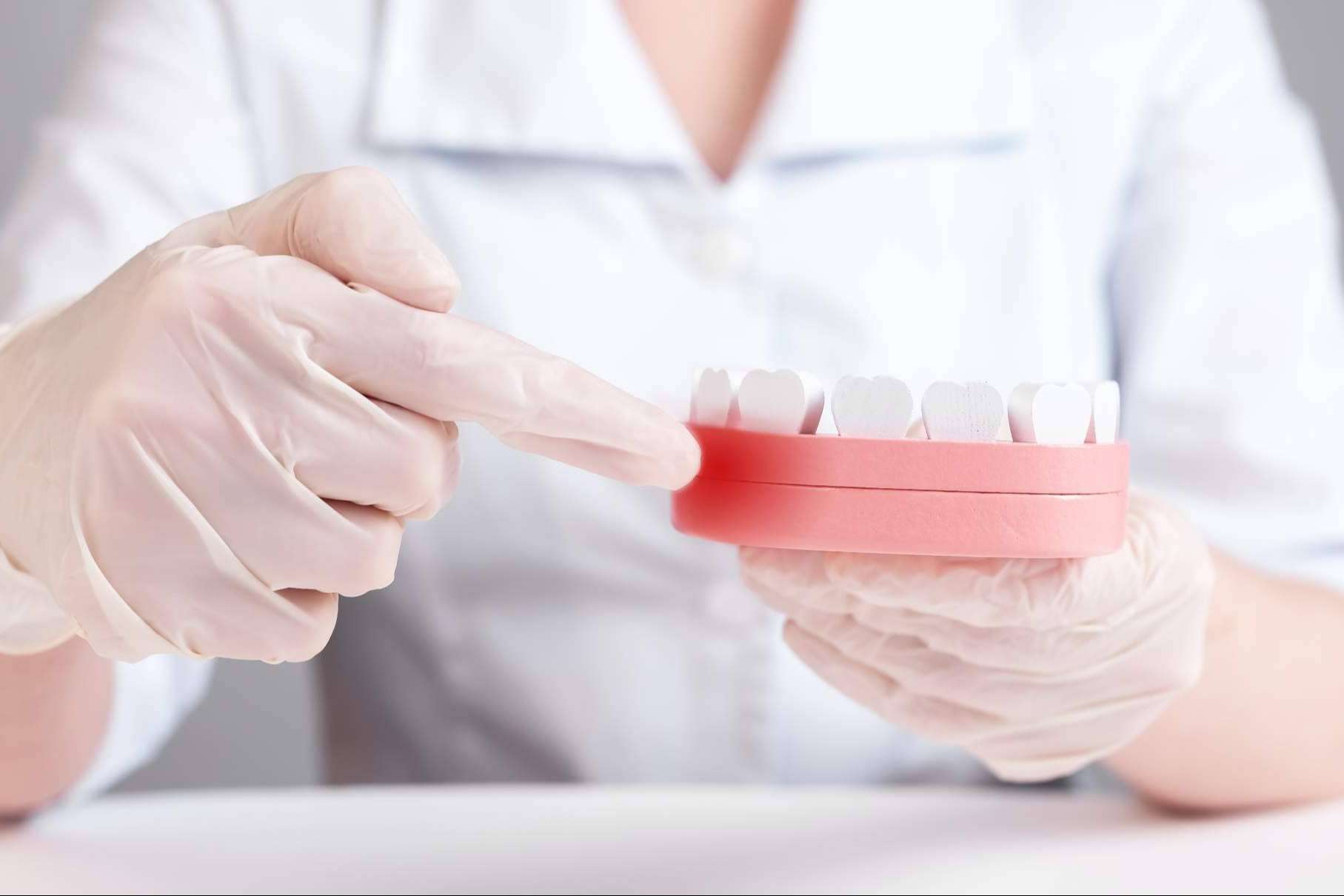 Clínica Dental Delgado ofrece tratamientos de periodoncia a través de odontólogos especializados