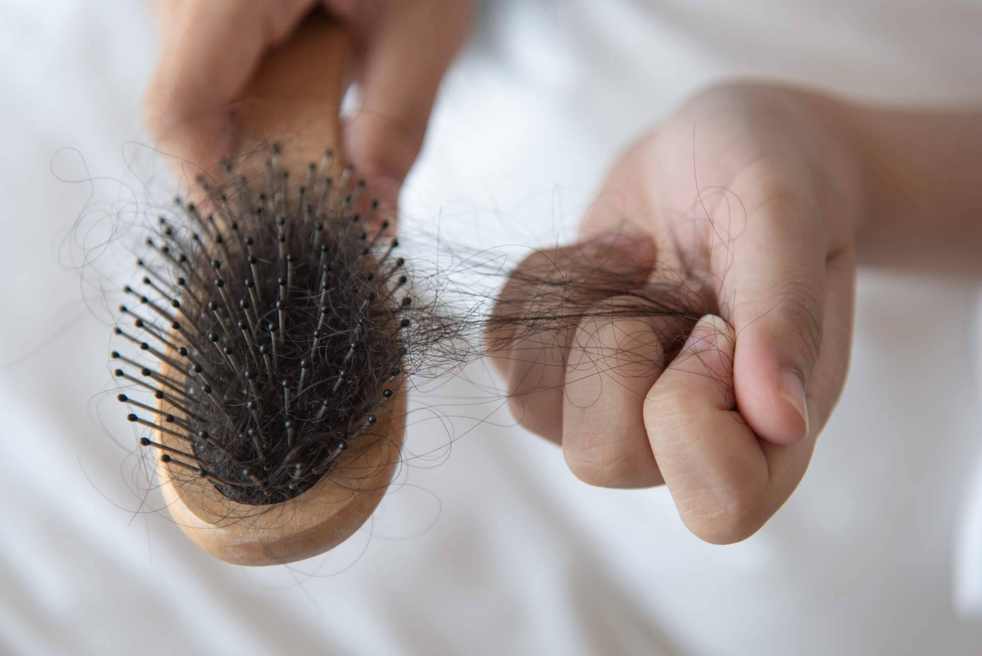 El método de Capilar Innovation Clinic para combatir la alopecia femenina