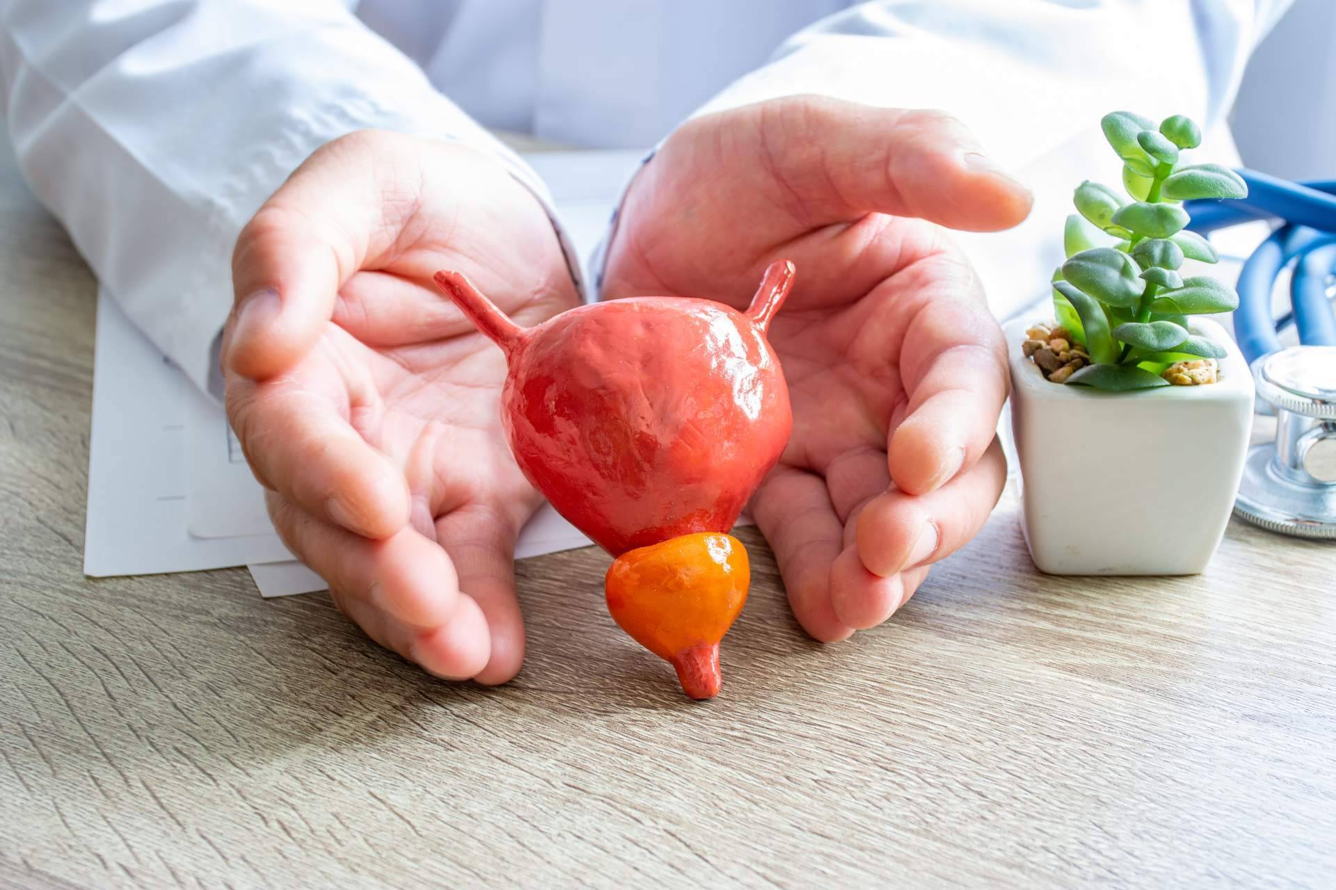 La realidad del cáncer de vejiga en España; 23.000 casos y 5 muertes por cada 100.000 habitantes por año