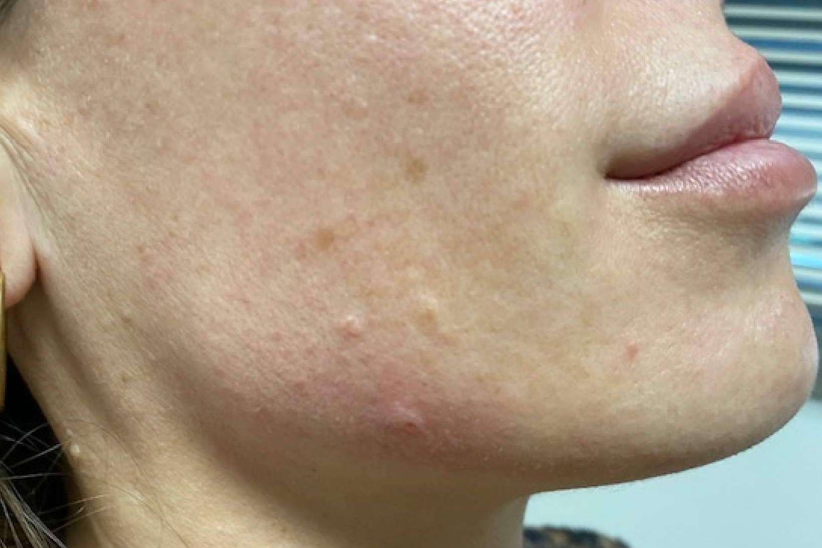 El tratamiento facial completo para mejorar el aspecto de la piel de Clínica Amalfi