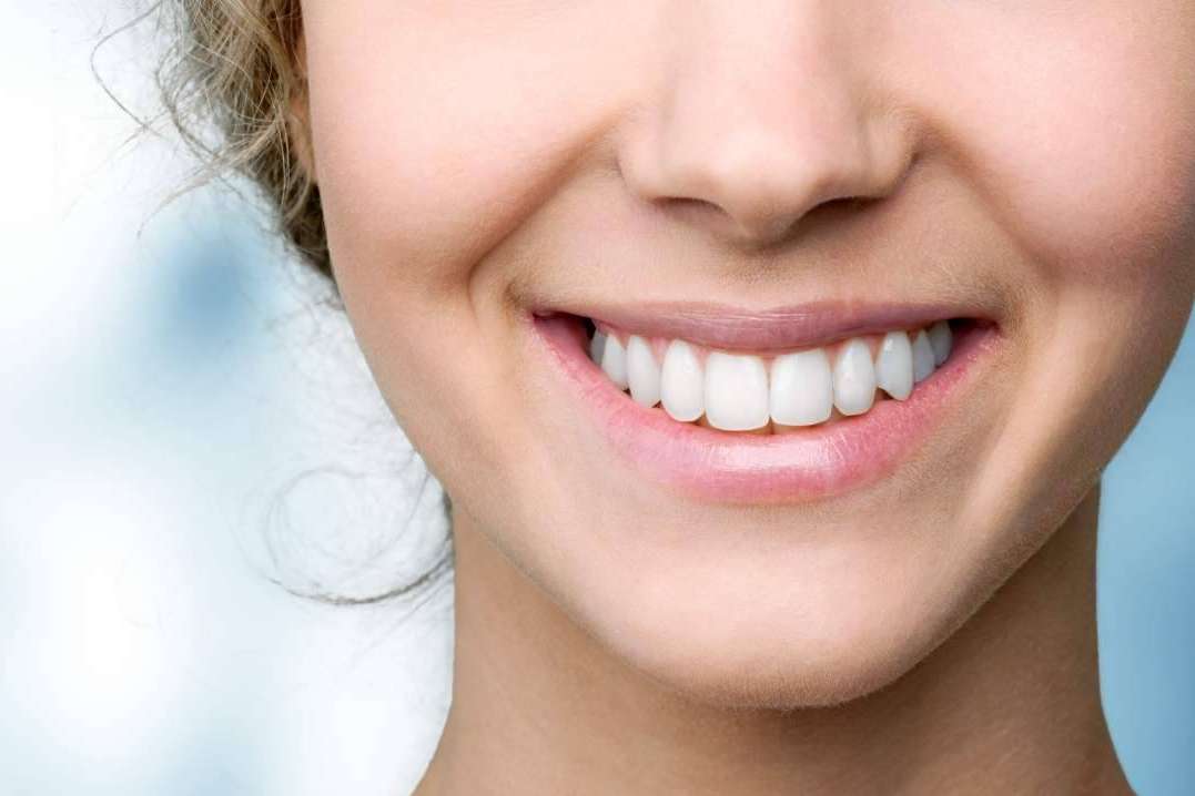 En qué consiste la cirugía de sonrisa gingival
