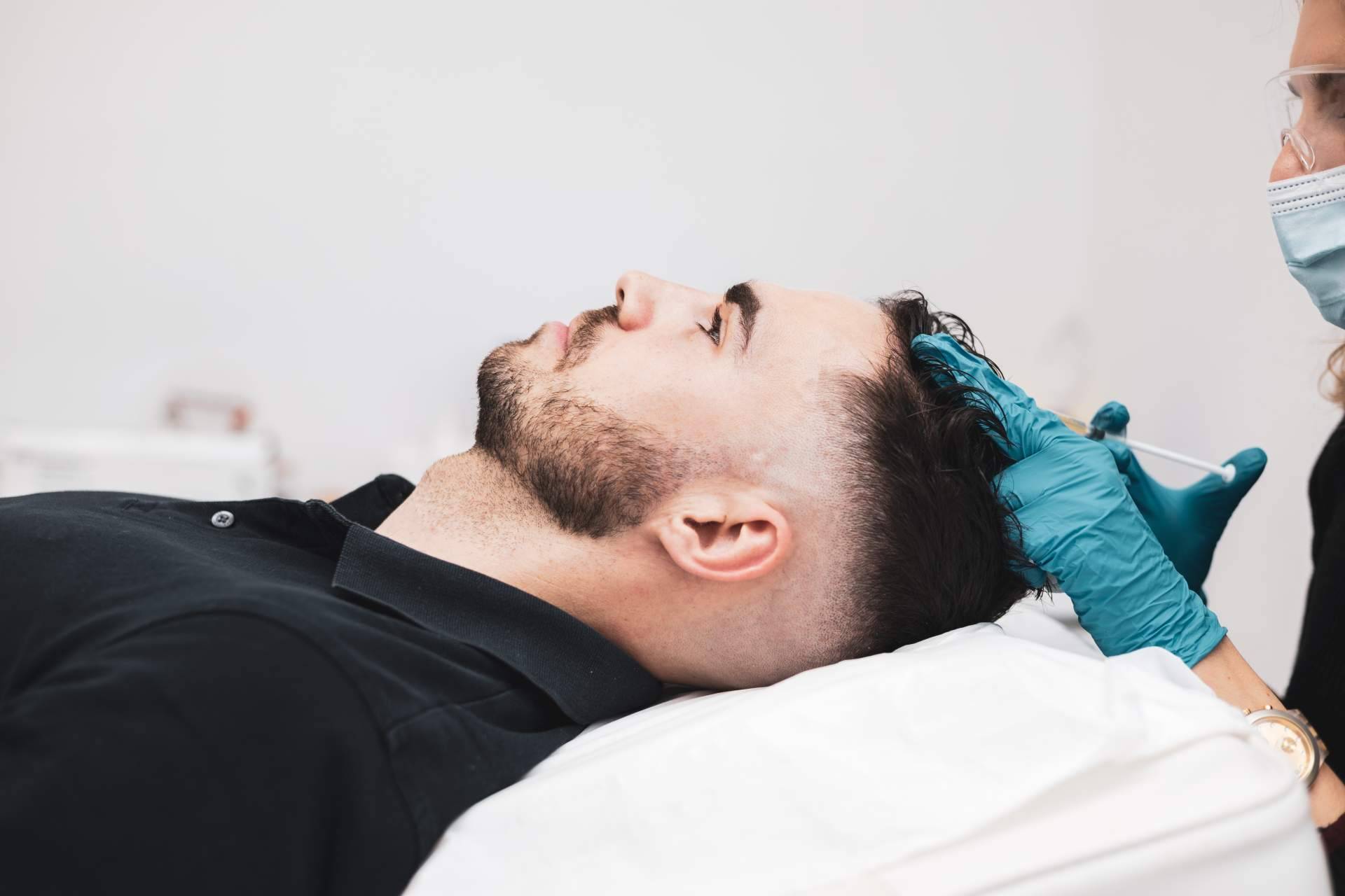 Centro Estética El Pilar estimula el crecimiento del cabello a través del tratamiento innovador PRP capilar