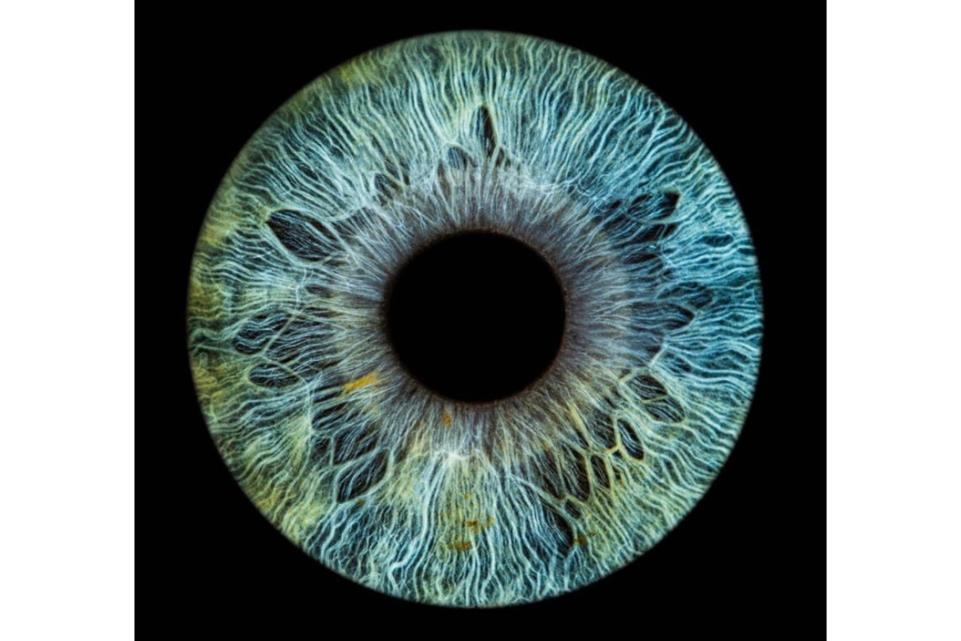 Clínica Eyecos presenta algunas celebridades con heterocromía ocular