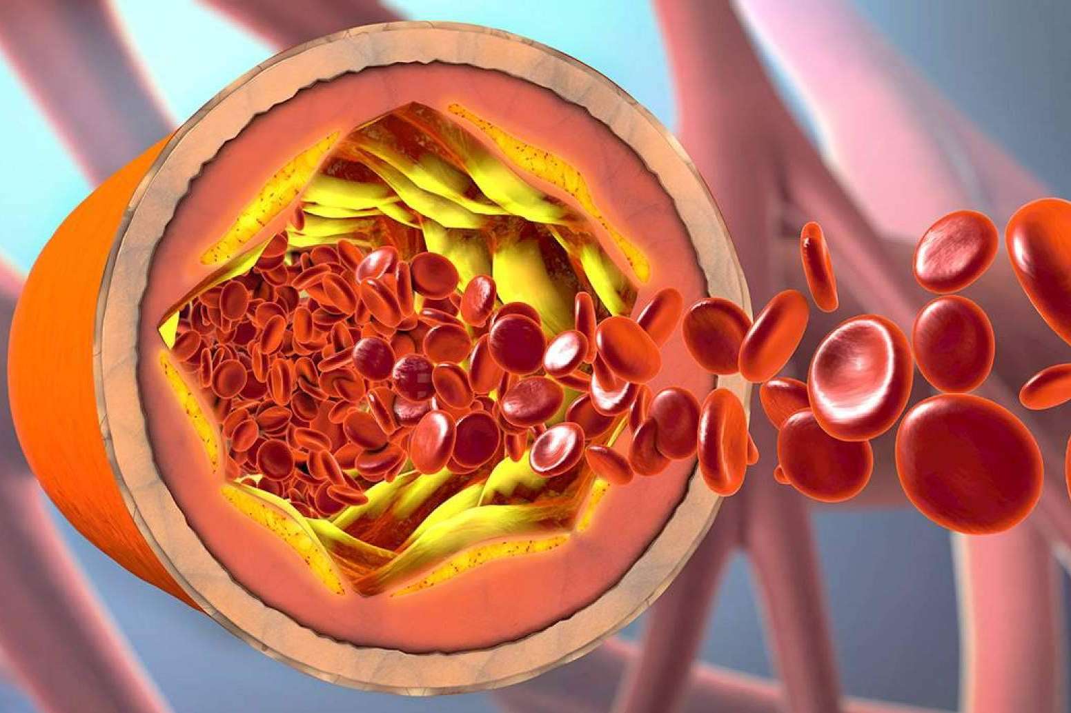 ReduCol 25 es la fórmula innovadora con levadura roja de arroz rojo de la marca Beverly Nutrition