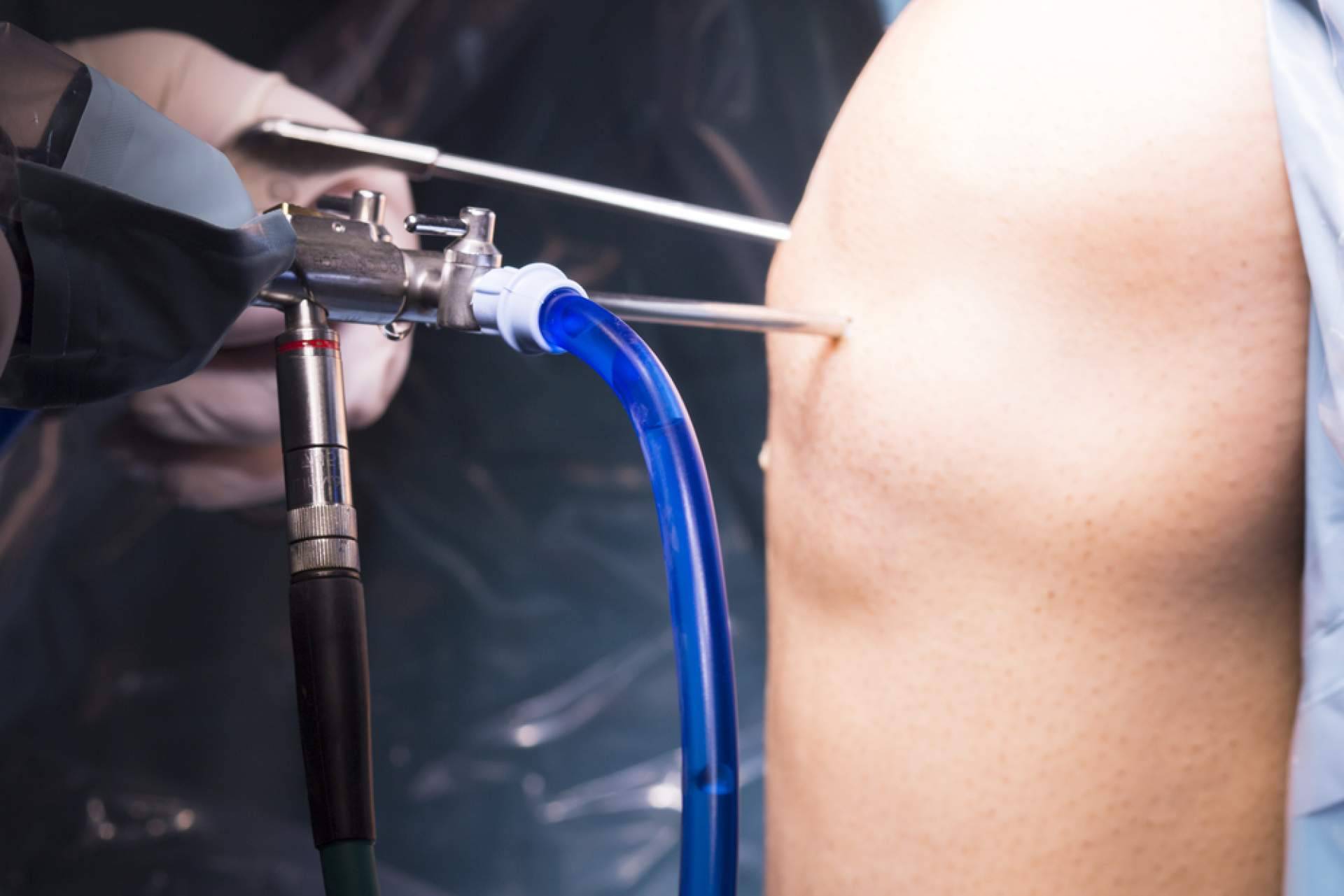¿Dónde encontrar tratamientos de artroscopia de rodilla? Clínica Jaime I de Catarroja