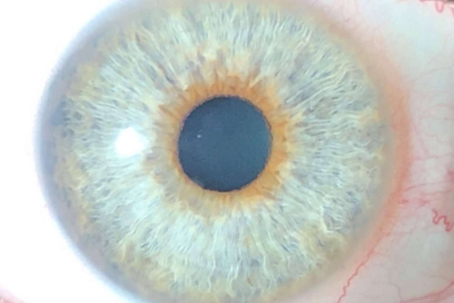 Eyecos estudia la distribución del color de ojos