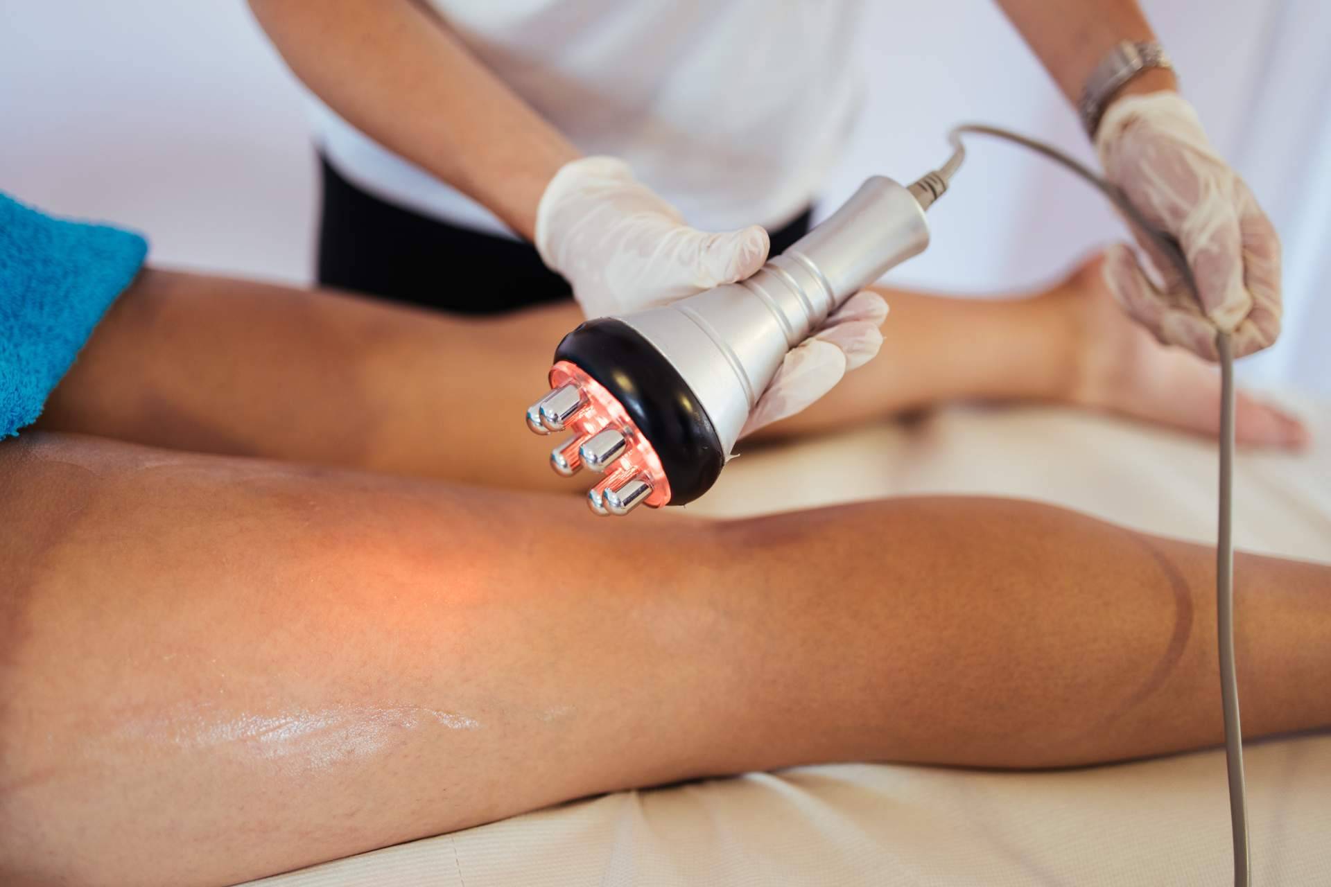 Las características principales del tratamiento de radiofrecuencia corporal, de la mano del Centro Médico El Pilar