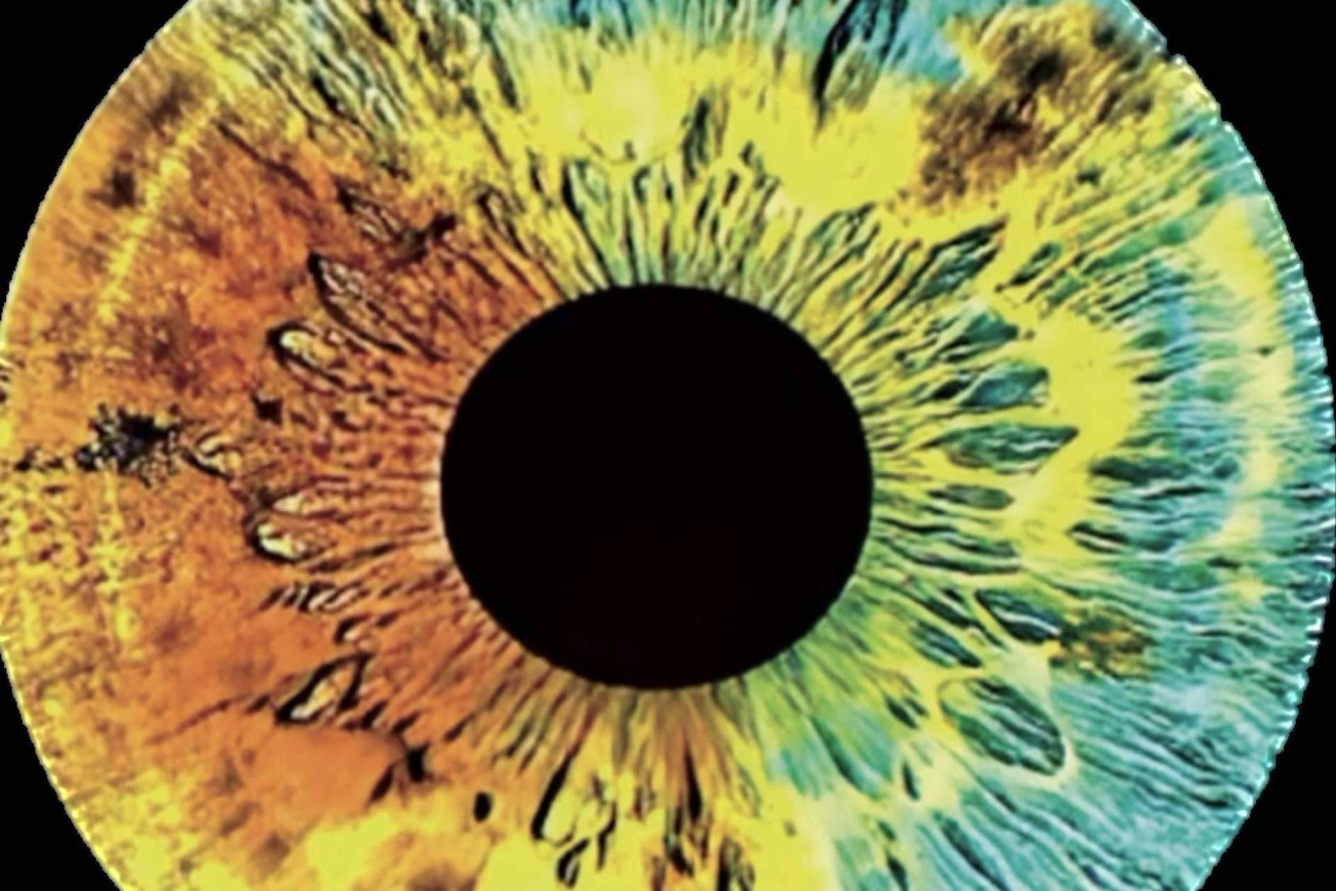 Investigación sobre los genes del color de ojos, por Clínica Eyecos