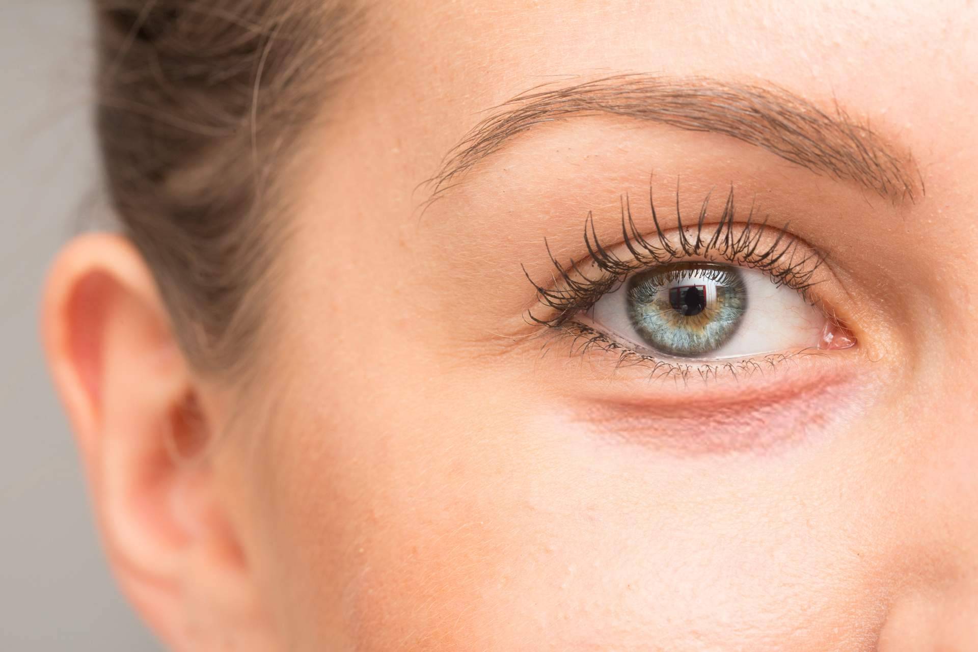 Centro Médico El Pilar y la eliminación de ojeras con ácido hialurónico